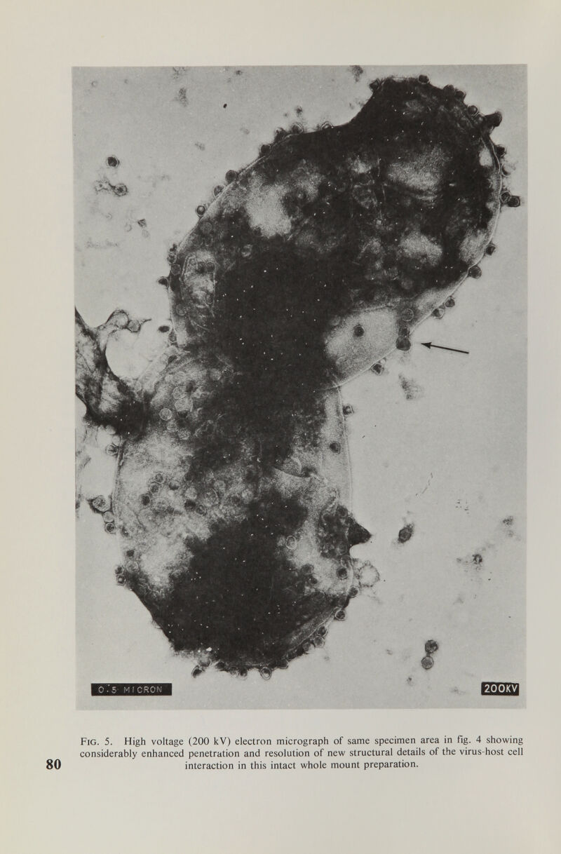 Fig. 5. High voltage (200 kV) electron micrograph of same specimen area in fig. 4 showing considerably enhanced penetration and resolution of new structural details of the virus-host cell interaction in this intact whole mount preparation.