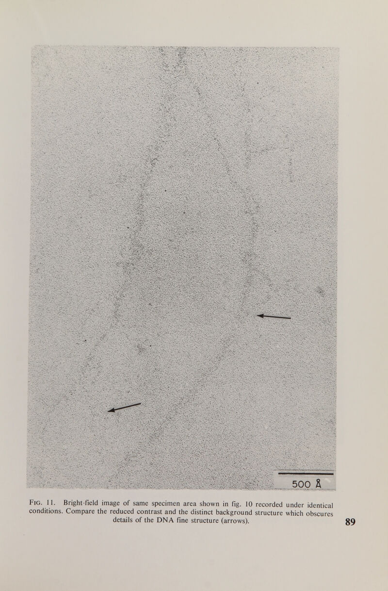 Fig. 11. Bright-field image of same specimen area shown in fig. 10 conditions. Compare the reduced contrast and the distinct background details of the DNA fine structure (arrows). recorded structure under identical which obscures