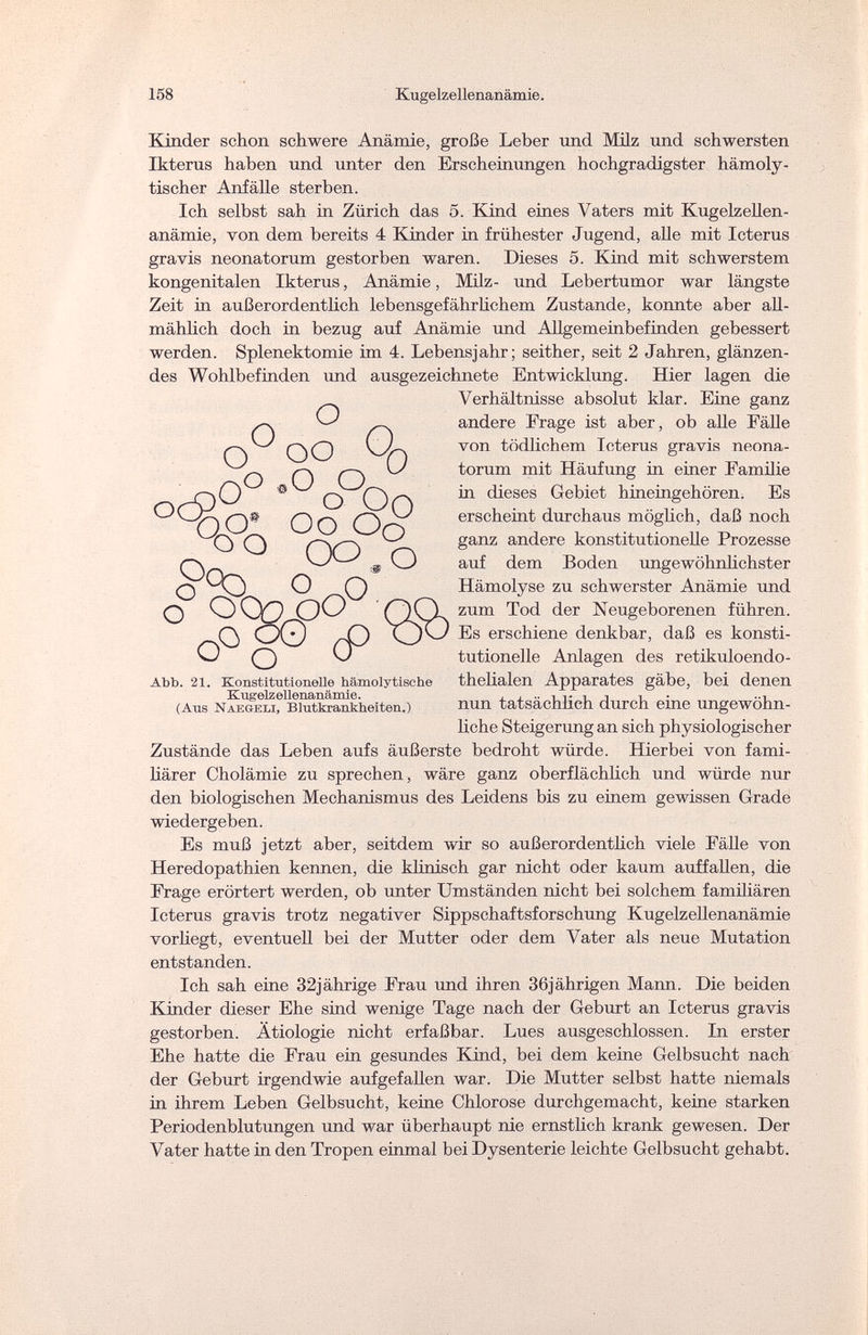 158 Kugelzellenanämie. Kinder schon schwere Anämie, große Leber und Milz und schwersten Ikterus haben und unter den Erscheinungen hochgradigster hämoly¬ tischer Anfälle sterben. Ich selbst sah in Zürich das 5. Kind eines Vaters mit Kugelzellen¬ anämie, von dem bereits 4 Kinder in frühester Jugend, alle mit Icterus gravis neonatorum gestorben waren. Dieses 5. Kind mit schwerstem kongenitalen Ikterus, Anämie, Milz- und Lebertumor war längste Zeit in außerordentlich lebensgefährlichem Zustande, konnte aber all¬ mählich doch in bezug auf Anämie und Allgemeinbefinden gebessert werden. Splenektomie im 4. Lebensjahr; seither, seit 2 Jahren, glänzen¬ des Wohlbefinden und ausgezeichnete Entwicklung. Hier lagen die Verhältnisse absolut klar. Eine ganz O ^ andere Frage ist aber, ob alle Fälle О О VOn tödlichem Icterus gravis neona- W torum mit Häufung in einer Familie & о On 111 dieses Gebiet hineingehören. Es О О О erscheint durchaus möglich, daß noch wo О no ganz andere konstitutionelle Prozesse VA- О auf dem Boden ungewöhnlichster О o^oHämolyse zu schwerster Anämie und О OC^OO no zum Tod der Neugeborenen führen. Q O0 X) Es erschiene denkbar, daß es konsti- O о ~ tutionelle Anlagen des retikuloendo- Abb. 21. Konstitutionelle hämolytische thelialen Apparates gäbe, bei denen Kugelzellenanämie. а x •• -uv i. j i. • i (Aus Naegeli, Blutkrankheiten.) nun tatsächlich durch eme ungewöhn¬ liche Steigerung an sich physiologischer Zustände das Leben aufs äußerste bedroht würde. Hierbei von fami¬ liärer Cholämie zu sprechen, wäre ganz oberflächlich und würde nur den biologischen Mechanismus des Leidens bis zu einem gewissen Grade wiedergeben. Es muß jetzt aber, seitdem wir so außerordentlich viele Fälle von Heredopathien kennen, die klinisch gar nicht oder kaum auffallen, die Frage erörtert werden, ob unter Umständen nicht bei solchem familiären Icterus gravis trotz negativer Sippschaftsforschung Kugelzellenanämie vorhegt, eventuell bei der Mutter oder dem Vater als neue Mutation entstanden. Ich sah eine 32jährige Frau und ihren 36jährigen Mann. Die beiden Kinder dieser Ehe sind wenige Tage nach der Geburt an Icterus gravis gestorben. Ätiologie nicht erfaßbar. Lues ausgeschlossen. In erster Ehe hatte die Frau ein gesundes Kind, bei dem keine Gelbsucht nach der Geburt irgendwie aufgefallen war. Die Mutter selbst hatte niemals in ihrem Leben Gelbsucht, keine Chlorose durchgemacht, keine starken Periodenblutungen und war überhaupt nie ernstlich krank gewesen. Der Vater hatte in den Tropen einmal bei Dysenterie leichte Gelbsucht gehabt.