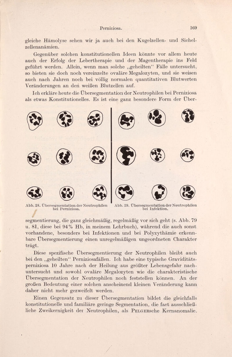 Perniziosa. 169 gleiche Hämolyse sehen wir ja auch bei den Kugelzellen- und Sichel¬ zellenanämien. Gegenüber solchen konstitutionellen Ideen könnte vor allem heute auch der Erfolg der Lebertherapie und der Magentherapie ins Feld geführt werden. Allein, wenn man solche „geheilten Fälle untersucht, so bieten sie doch noch vereinzelte ovaläre Megalozyten, und sie weisen auch nach Jahren noch bei völlig normalen quantitativen Blutwerten Veränderungen an den weißen Blutzellen auf. Ich erkläre heute die Übersegmentation der Neutrophilen bei Perniziosa als etwas Konstitutionelles. Es ist eine ganz besondere Form der Über- Abb. 28. Übersegmentation der Neutrophilen Abb. 29. Übersegmentation der Neutrophilen bei Perniziosa. bei Infektion. § segmentierung, die ganz gleichmäßig, regelmäßig vor sich geht (s. Abb. 79 u. 81, diese bei 94% Hb, in meinem Lehrbuch), während die auch sonst vorhandene, besonders bei Infektionen und bei Polyzythämie erkenn¬ bare Übersegmentierung einen unregelmäßigen ungeordneten Charakter trägt. Diese spezifische Übersegmentierung der Neutrophilen bleibt auch bei den „geheilten Perniziosafällen. Ich habe eine typische Graviditäts- perniziosa 10 Jahre nach der Heilung aus größter Lebensgefahr nach¬ untersucht und sowohl ovaläre Megalozyten wie die charakteristische Übersegmentation der Neutrophilen noch feststellen können. An der großen Bedeutung einer solchen anscheinend kleinen Veränderung kann daher nicht mehr gezweifelt werden. Einen Gegensatz zu dieser Übersegmentation bildet die gleichfalls konstitutionelle und familiäre geringe Segmentation, die fast ausschließ¬ liche Zweikernigkeit der Neutrophilen, als PELGERsche Kernanomalie. /