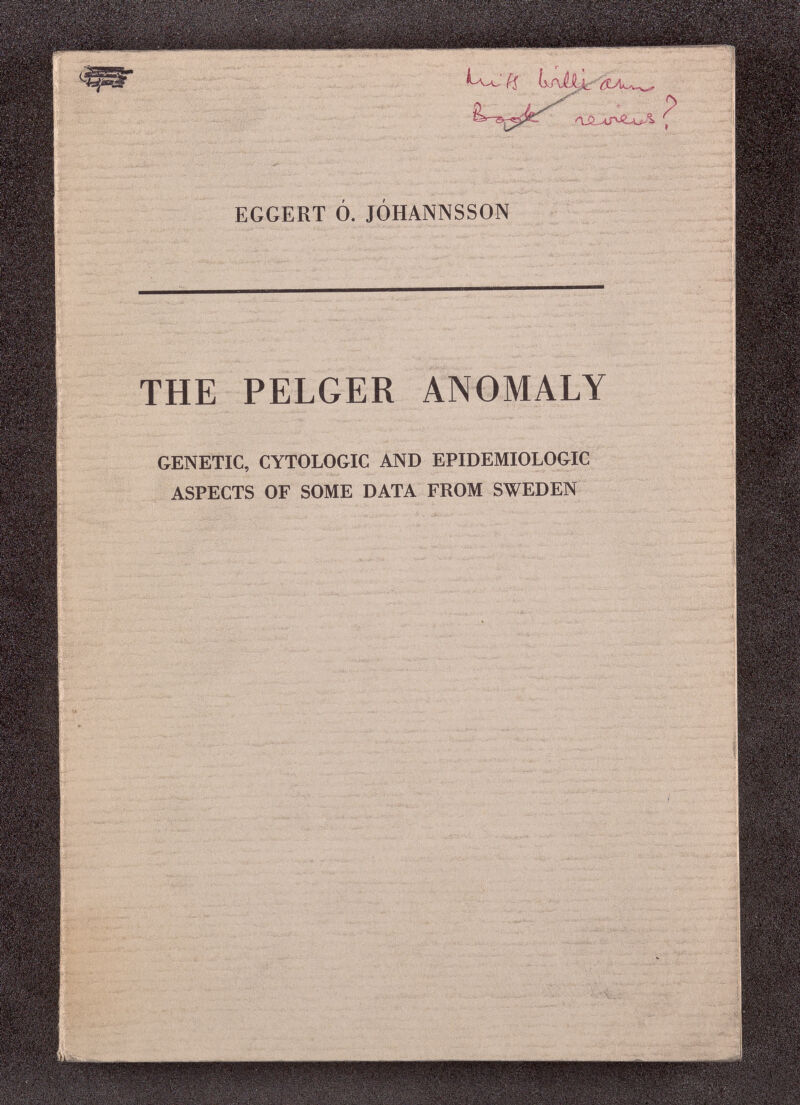 EGGERT 0. J0HANNSS0N THE PELGER ANOMALY GENETIC, CYTOLOGIC AND EPIDEMIOLOGIC ASPECTS OF SOME DATA FROM SWEDEN