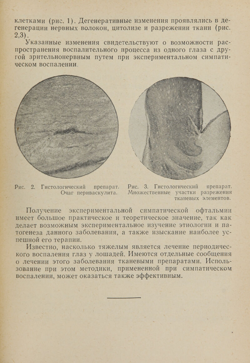 клетками (рис. 1). Дегенеративные изменения проявлялись в де¬ генерации нервных волокон, цитолизе и разрежении ткани (рис. 2,3). Указанные изменения свидетельствуют о возможности рас¬ пространения воспалительного процесса из одного глаза с дру¬ гой зрительнонервным путем при экспериментальном симпати¬ ческом воспалении. Рис. 2. Гистологический препарат. Рис. 3. Гистологический препарат. Очаг периваскулита. Множественные участки разрежения тканевых элементов. Получение экспериментальной симпатической офтальмии имеет больпдое практическое и теоретическое значение, так как делает возможным экспериментальное изучение этиологии и па¬ тогенеза данного заболевания, а также изыскание наиболее ус¬ пешной его терапии. Известно, насколько тяжелым является лечение периодичес¬ кого воспаления глаз у лошадей. Имеются отдельные сообщения о лечении этого заболевания тканевыми препаратами. Исполь¬ зование при этом методики, примененной при симпатическом воспалении, может оказаться также эффективным.