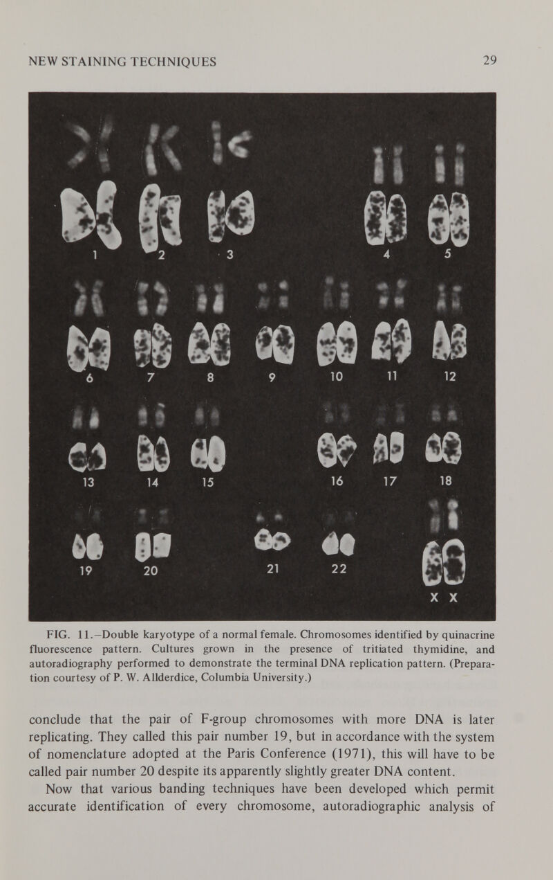 NEW STAINING TECHNIQUES 29 6 7 8 9 10 n 12 Il il f f f • ft C.5 SÔ 88 e? ЯВ Û0 13 14 15 16 17 18 mm ■'-t à • I |: M SI *• en 19 20 21 22 X X FIG. II.—Double karyotype of a normal female. Chromosomes identified by quinacrine fluorescence pattern. Cultures grown in the presence of tritiated thymidine, and autoradiography performed to demonstrate the terminal DNA replication pattern. (Prepara¬ tion courtesy of P. W. Allderdice, Columbia University.) conclude that the pair of F-group chromosomes with more DNA is later replicating. They called this pair number 19, but in accordance with the system of nomenclature adopted at the Paris Conference (1971), this will have to be called pair number 20 despite its apparently slightly greater DNA content. Now that various banding techniques have been developed which permit accurate identification of every chromosome, autoradiographic analysis of