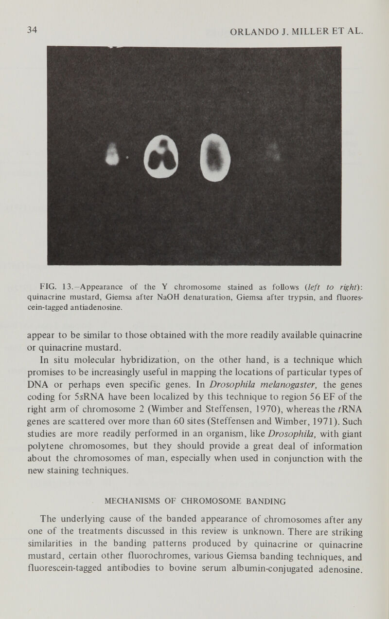 34 ORLANDO J. MILLER ET AL. Ô FIG. 13.-Appearance of the Y chromosome stained as follows {left to right): quinacrine mustard, Giemsa after NaOH denaturation, Giemsa after trypsin, and fluores- cein-tagged antiadenosine. appear to be similar to those obtained with the more readily available quinacrine or quinacrine mustard. In situ molecular hybridization, on the other hand, is a technique which promises to be increasingly useful in mapping the locations of particular types of DNA or perhaps even specific genes. In Drosophila melanogaster, the genes coding for SsRNA have been localized by this technique to region 56 EF of the right arm of chromosome 2 (Wimber and Steffensen, 1970), whereas the íRNA genes are scattered over more than 60 sites (Steffensen and Wimber, 1971). Such studies are more readily performed in an organism, like Drosophila, with giant polytene chromosomes, but they should provide a great deal of information about the chromosomes of man, especially when used in conjunction with the new staining techniques. MEŒANISMS OF CHROMOSOME BANDING The underlying cause of the banded appearance of chromosomes after any one of the treatments discussed in this review is unknown. There are striking similarities in the banding patterns produced by quinacrine or quinacrine mustard, certain other fluorochromes, various Giemsa banding techniques, and fluorescein-tagged antibodies to bovine serum albumin-conjugated adenosine.