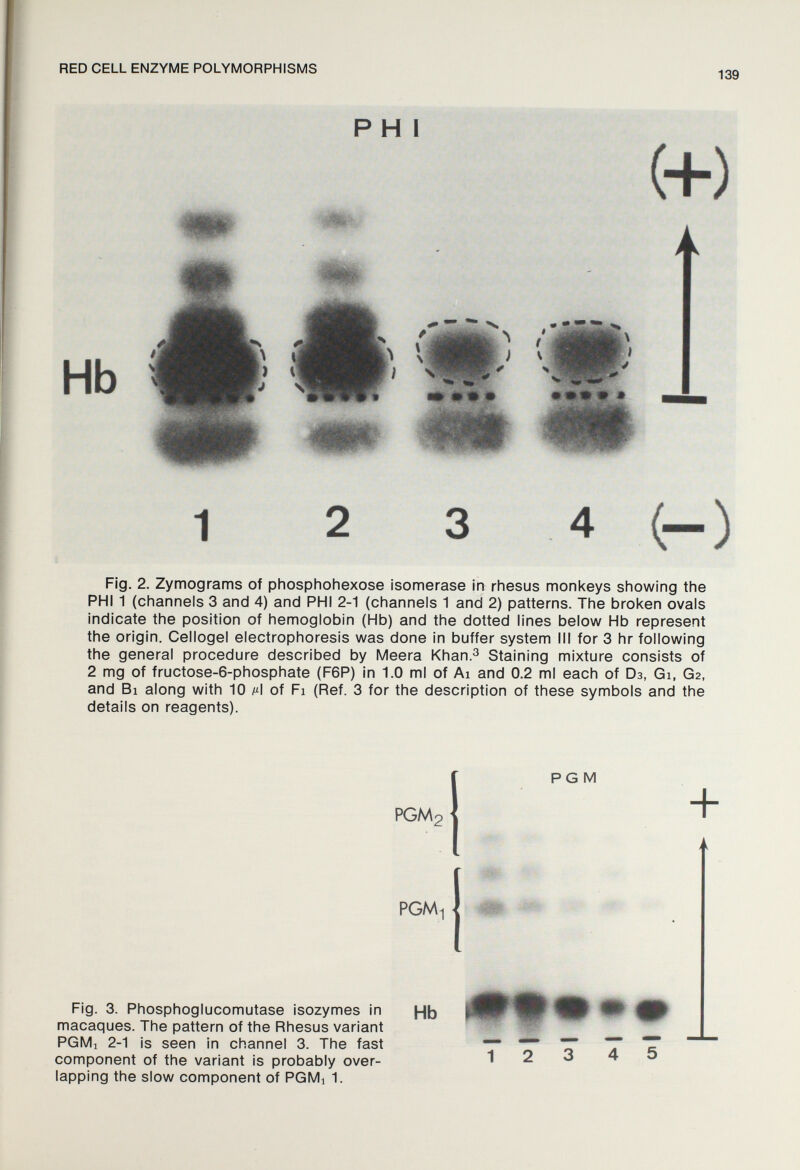 RED CELL ENZYME POLYMORPHISMS 139 P H I Hb (+) 1 2 3 4 (-) Fig. 2. Zymograms of phosphohexose isomerase in rhesus monkeys showing the PHI 1 (channels 3 and 4) and PHI 2-1 (channels 1 and 2) patterns. The broken ovals indicate the position of hemoglobin (Hb) and the dotted lines below Hb represent the origin. Cellogel electrophoresis was done in buffer system III for 3 hr following the general procedure described by Meera Khan.^ Staining mixture consists of 2 mg of fructose-6-phosphate (F6P) in 1.0 ml of Ai and 0.2 ml each of Оз, Gi, G2, and Bi along with 10 M of Fi (Ref. 3 for the description of these symbols and the details on reagents). PGM2 PGM + PGM^ Fig. 3. Phosphoglucomutase isozymes in macaques. The pattern of the Rhesus variant PGMi 2-1 is seen in channel 3. The fast component of the variant is probably over¬ lapping the slow component of PGMi 1. Hb