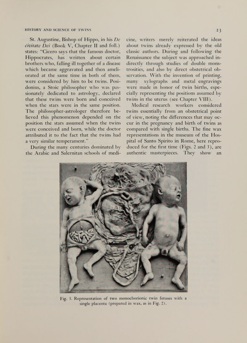 HISTORY AND SCIENCE OF TWINS 23 St. Augustine, Bishop of Hippo, in his De civitate Dei (Book V, Chapter II and foil.) states: Cicero says that the famous doctor, Hippocrates, has written about certain brothers who, falling ill together of a disease which became aggravated and then ameli¬ orated at the same time in both of them, were considered by him to be twins. Posi- donius, a Stoic philosopher who was pas¬ sionately dedicated to astrology, declared that these twins were born and conceived when the stars were in the same position. The philosopher-astrologer therefore be¬ lieved this phenomenon depended on the position the stars assumed when the twins were conceived and born, while the doctor attributed it to the fact that the twins had a very similar temperament. During the many centuries dominated by the Arabic and Salernitan schools of medi¬ cine, writers merely reiterated the ideas about twins already expressed by the old classic authors. During and following the Renaissance the subject was approached in¬ directly through studies of double mons¬ trosities, and also by direct obstetrical ob- servation. With the invention of printing, many xylographs and metal engravings were made in honor of гл\тп births, espe¬ cially representing the positions assumed by twins in the uterus (see Chapter VIII). Medical research workers considered twins essentially from an obstetrical point of view, noting the differences that may oc¬ cur in the pregnancy and birth of twins as compared with single births. The fine wax representations in the museum of the Hos¬ pital of Santo Spirito in Rome, here repro¬ duced for the first time (Figs. 2 and 3), are authentic masterpieces. They show an Fig. 3. Representation of two monochorionic twin fetuses with a single placenta (prepared in wax, as in Fig. 2).