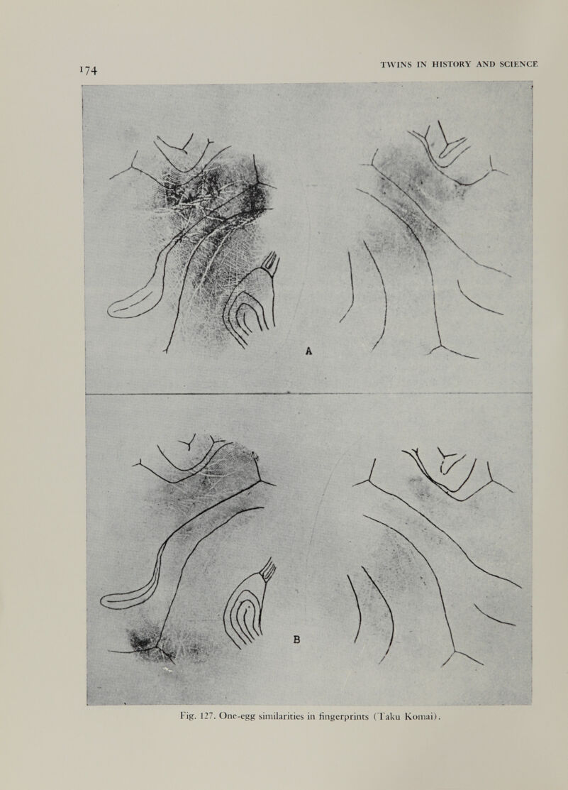 174 TWINS IN HISTORY AND SCIENCE r - ■' i... . - :■ ■/ Fig. 127. One-egg similarities in fingerprints (Taku Komai).