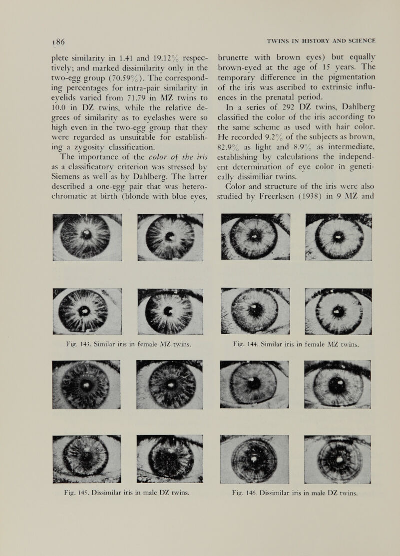 TWINS IN HISTORY AND SCIENCE plete similarity in 1.41 and 19.12% respec¬ tively; and marked dissimilarity only in the two-egg group (70.59%). The correspond¬ ing percentages for intra-pair similarity in eyelids varied from 71.79 in MZ twins to 10.0 in DZ twins, while the relative de¬ grees of similarity as to eyelashes were so high even in the two-egg group that they were regarded as unsuitable for establish¬ ing a zygosity classification. The importance of the color of the iris as a classificatory criterion was stressed by Siemens as well as by Dahlberg. The latter described a one-egg pair that was hetero- chromatic at birth (blonde with blue eyes, brunette with brown eyes) but equally brown-eyed at the age of 15 years. The temporary difference in the pigmentation of the iris was ascribed to extrinsic influ¬ ences in the prenatal period. In a series of 292 DZ twins, Dahlberg classified the color of the iris according to the same scheme as used with hair color. He recorded 9.2% of the subjects as brown, 82.9% as light and 8.9% as intermediate, establishing by calculations the independ¬ ent determination of eye color in geneti¬ cally dissimiliar twins. Color and structure of the iris were also studied by Freerksen (1938) in 9 MZ and