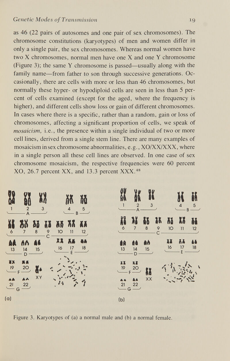 Genetic Modes of Transmission 19 as 46 (22 pairs of autosomes and one pair of sex chromosomes). The chromosome constitutions (karyotypes) of men and women differ in only a single pair, the sex chromosomes. Whereas normal women have two X chromosomes, normal men have one X and one Y chromosome (Figure 3); the same Y chromosome is passed—usually along with the family name—from father to son through successive generations. Oc¬ casionally, there are cells with more or less than 46 chromosomes, but normally these hyper- or hypodiploid cells are seen in less than 5 per¬ cent of cells examined (except for the aged, where the frequency is higher), and different cells show loss or gain of different chromosomes. In cases where there is a specific, rather than a random, gain or loss of chromosomes, affecting a significant proportion of cells, we speak of mosaicism, i.e., the presence within a single individual of two or more cell lines, derived from a single stem line. There are many examples of mosaicism in sex chromosome abnormalities, e.g., XO/XX/XXX, where in a single person all these cell lines are observed. In one case of sex chromosome mosaicism, the respective frequencies were 60 percent XO, 26.7 percent XX, and 13.3 percent XXX. S SS и J« и ? Ц 'f H К 2 A 4 5 ^ В m sü u n j» xx M AA АЛ Al 13 14 15  D ' 8 9 10 11 12 С ' XX M M 16 17 18 V E / MX ШЯ 19 20 II дл AA XY 21 22 G ' « \ , «. ' , ... (a) 2 3 A ' 4 5 ^ В il ÌÌ U и » и li ó 7 8 9 10 11 12 ^ С ^ ёй H M 13 14 15  D XX H àè 16 17 18 ' E XX XX 19 20 ты F Il ** «A XX 21 22 ^ G ' (b) ^ Í \ T V Figure 3. Karyotypes of (a) a normal maie and (b) a normal female.