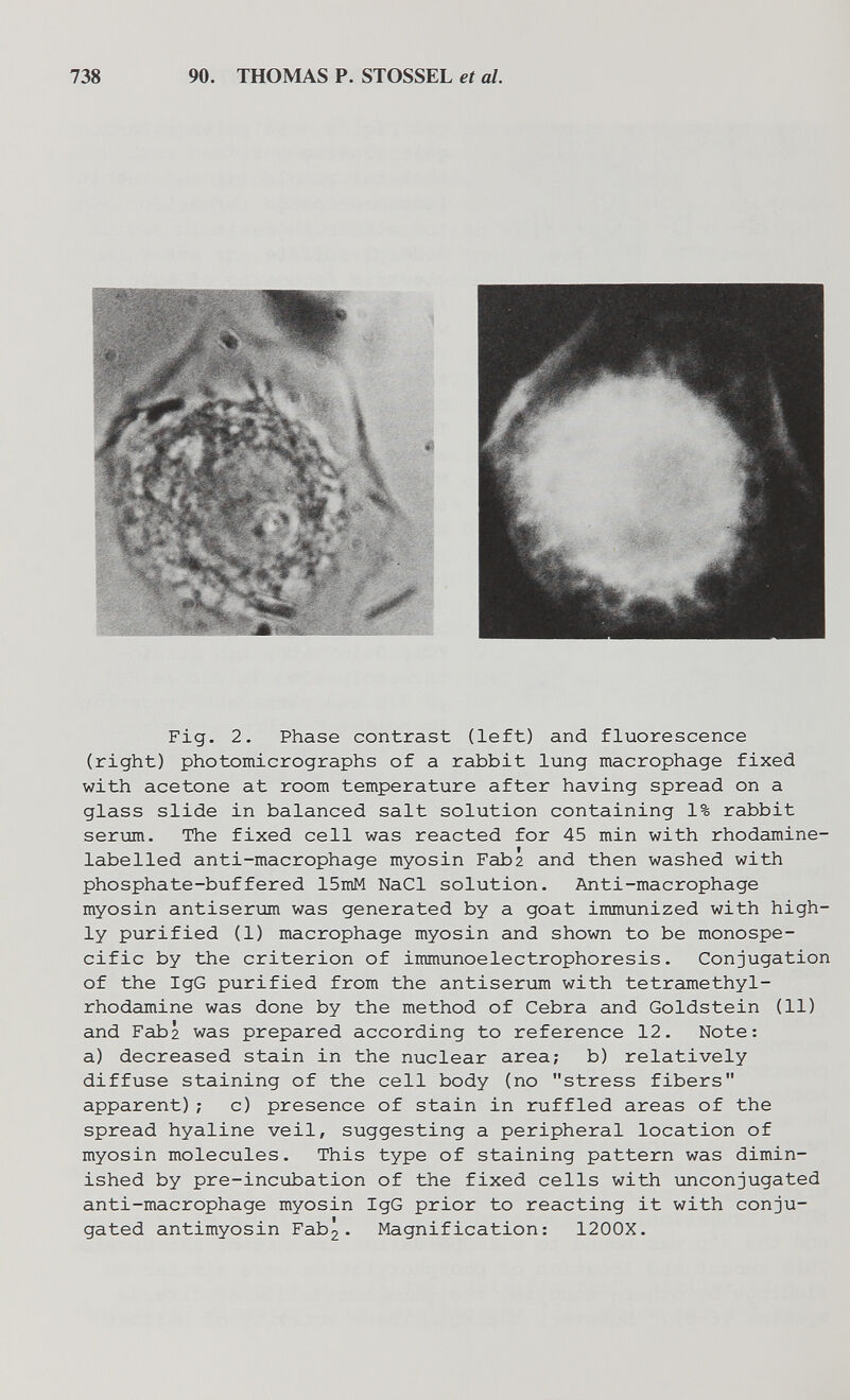 738 90. THOMAS P. STOSSEL et al. Fig. 2. Phase contrast (left) and fluorescence (right) photomicrographs of a rabbit lung macrophage fixed with acetone at room temperature after having spread on a glass slide in balanced salt solution containing 1% rabbit serum. The fixed cell was reacted for 45 min with rhodamine- labelled anti-macrophage myosin Faba and then washed with phosphate-buffered 15mM NaCl solution. Anti-macrophage myosin antiserum was generated by a goat immunized with high¬ ly purified (1) macrophage myosin and shown to be monospe¬ cific by the criterion of immunoelectrophoresis. Conjugation of the IgG purified from the antiserum with tetramethyl- rhodamine was done by the method of Cebra and Goldstein (11) and Fab2 was prepared according to reference 12. Note: a) decreased stain in the nuclear area; b) relatively diffuse staining of the cell body (no stress fibers apparent); c) presence of stain in ruffled areas of the spread hyaline veil, suggesting a peripheral location of myosin molecules. This type of staining pattern was dimin¬ ished by pre-incubation of the fixed cells with unconjugated anti-macrophage myosin IgG prior to reacting it with conju¬ gated antimyosin Fab^. Magnification: 1200X.