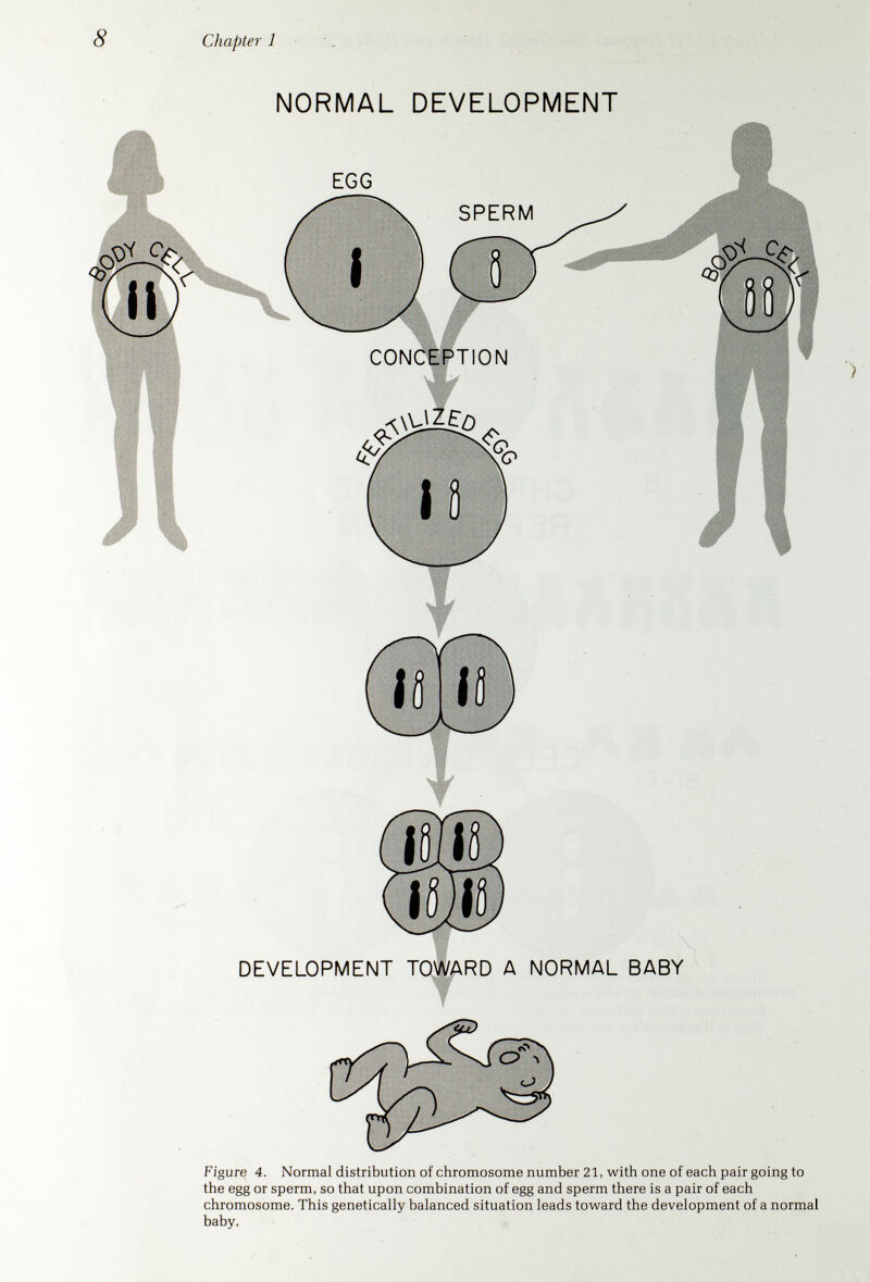 1 о Chapter 1 down's syndrome FAULTY CHROMOSOME DISTRIBUTION DEVELOPMENT TOWARD AJBABY WITH DOWN'S SYNDROME Figure 6. Faulty distribution of a 21 chromosome in the first cell division of the fertilized egg, leading to 21 trisomy and a baby with Down's syndrome.