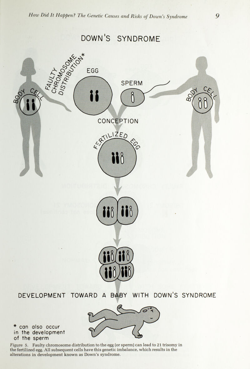 How Did It Happen? The Genetic Causes and Risks oj Down's Syndrome 11 DOWNS SYNDROME (mosaic) NORMAL FAULTY CHROMOSOME DISTRIBUTION TRISOMY 21 MONOSOMY 21 (does not continue) DEVELOPMENT TOWARD A BABY WITH SOME FEATURES OF DOWN'S SYNDROME (MOSAIC) Figure 7. If faulty 21 chromosome distribution occurs in the second cell division, some of the baby's cells will be normal, and some will be 21 trisomie. This is called 21 tri- somy/normal mosaicism. Such babies may show partial features of Down's syndrome.