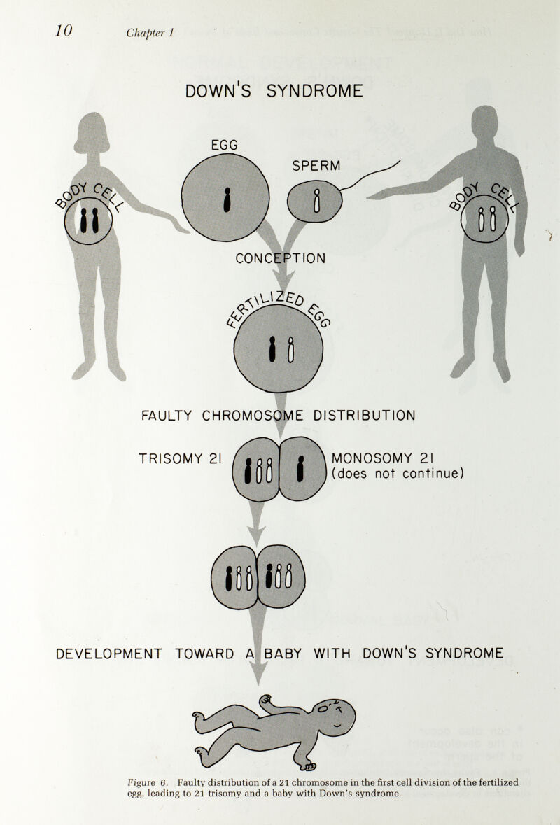 Chapter 1 The great majority of children with Down's syndrome have a full trisomy 21; that is, three number 21 chromosomes are present in every cell. In this situation, the timing of the fault in chromosome distribution can probably be placed either in the development of the egg or the sperm, or in the first cell division of the fertilized egg. It is usually impossible to tell which was the case for a specific child. A mistake in chromosome distribution can occur in the development of an egg or a sperm, because as each forms it goes through several cell divisions. In the beginning, the cells that will become egg or sperm have the parent's 46 chromosomes. In a type of division unique to sex cells, however, the chromosomes distribute so that each egg-to-be or sperm-to- be receives only one chromosome from each pair, or 23 in all. If the number 21 chromosomes do not distribute correctly and both go to one cell, the resultant egg or sperm will carry an extra number 21 chromo¬ some. When it combines with the other parent's egg or sperm, the result¬ ing fertilized egg will have three number 21 chromosomes and will therefore be destined to develop into a child having Down's syndrome. This is conceptualized in Figure 5. The second possibility is that both the egg and the sperm are normal, but in the very first cell division of the fertilized egg the number 21 chromosomes do not distribute correctly. One new cell receives three number 21 chromosomes (21 trisomy) and the other receives only one. A cell with only one number 21 chromosome cannot function properly and soon dies. The one with trisomy 21 will continue to multiply, and all the cells in the growing baby will have the extra number 21 chromosome. The baby will thus have a full trisomy 21 and consequently Down's syndrome. This is shown in Figure 6. In about 4 per cent of children with Down's syndrome, distribution mistakes occur in the second, or possibly third, division of the new devel¬ oping individual. As a result, some of the cells are normal and some have the trisomy 21. This admixture is called 21 trisomy/normal mosaicism, and is depicted in Figure 7. Because a baby who is a 21 trisomy/normal mosaic has a normal chromosome complement in some of his cells, he may have fewer of the physical characteristics and better mental perform¬ ance than Down's syndrome children with 21 trisomy in all cells. Mosai¬ cism can generally be determined by chromosome studies. Translocation 21 Trisomy, an Unusual Cause for Down's Syndrome In an additional 4 per cent of children with Down's syndrome the extra number 21 chromosome has broken and its long arm is attached to the broken end of another chromosome. This rearrangement of two chromosomes is called a translocation, as shown in Figure 8. Such a translocation chromosome may be made up of a rearrangement of a number 14 chromosome and a 21 chromosome, as one example. With a pair of normal 21 chromosomes plus this extra long arm of 21 chromo¬ some, the effect of the extra set of 21 genes is Down's syndrome. Though unusual, the translocation 21 trisomy can be distinguished from the full 21 trisomy only by chromosome studies. It deserves mention because it is