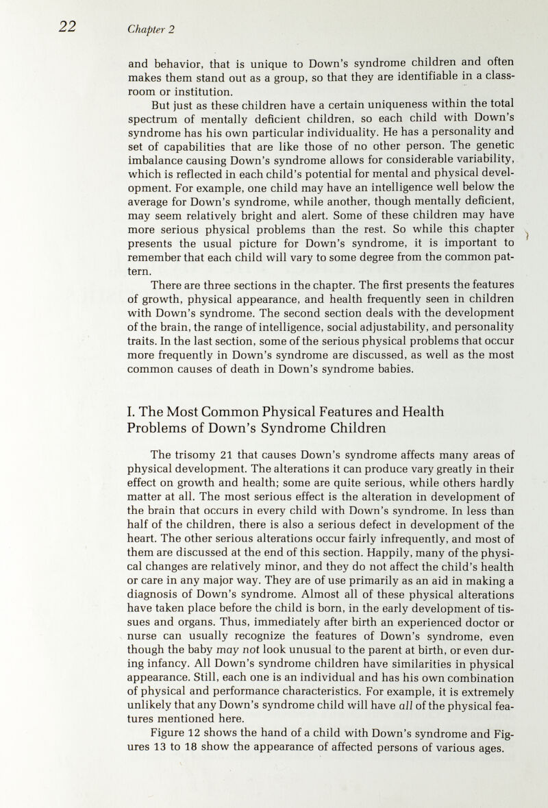 24 Chapter 2 Figure 13. These two young infants with Down's syndrome demonstrate the individual variability in the typical features, which include a tendency toward a relatively low nasal bridge and small nose with flat facial contour, upslanting of the eye fissures with slight folds at the inner corner of the eye, fullness in lower eyelids, small ears, and a tendency to protrude the tongue. Many of these features change with age, as is shown in the ensuing photos. (Lower photographs from Smith, D. W.: Recognizable Patterns of Human Malformation. Philadelphia, W. B. Saunders Co., 1970.)