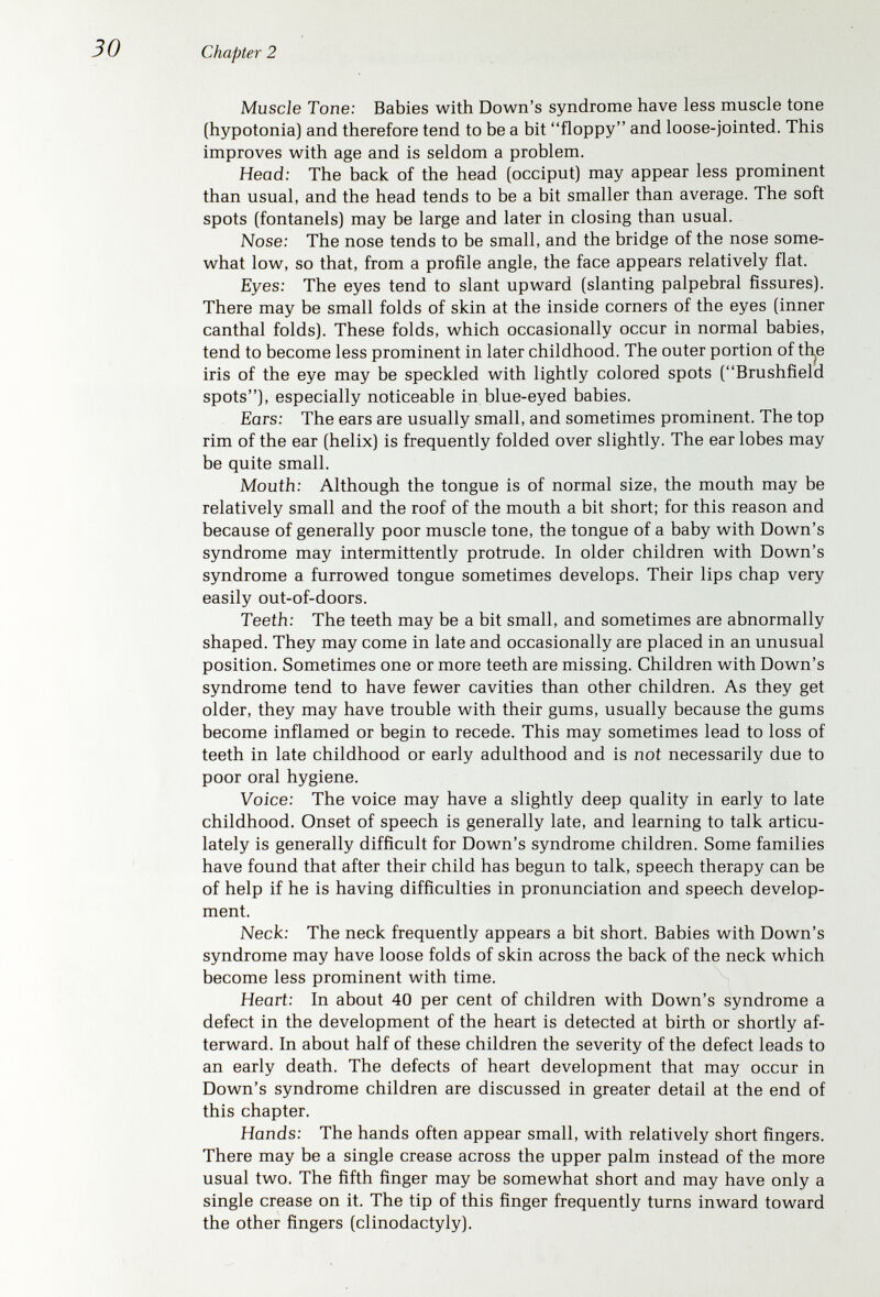 Chapter 2 HEIGHT Age in years Figure 19. Average linear growth in Down's syndrome as contrasted to the normal growth rate. (Adapted from Thelander, H. E., and Pryor, H. В.: Clinical Pediatrics 5:493, 1966.)