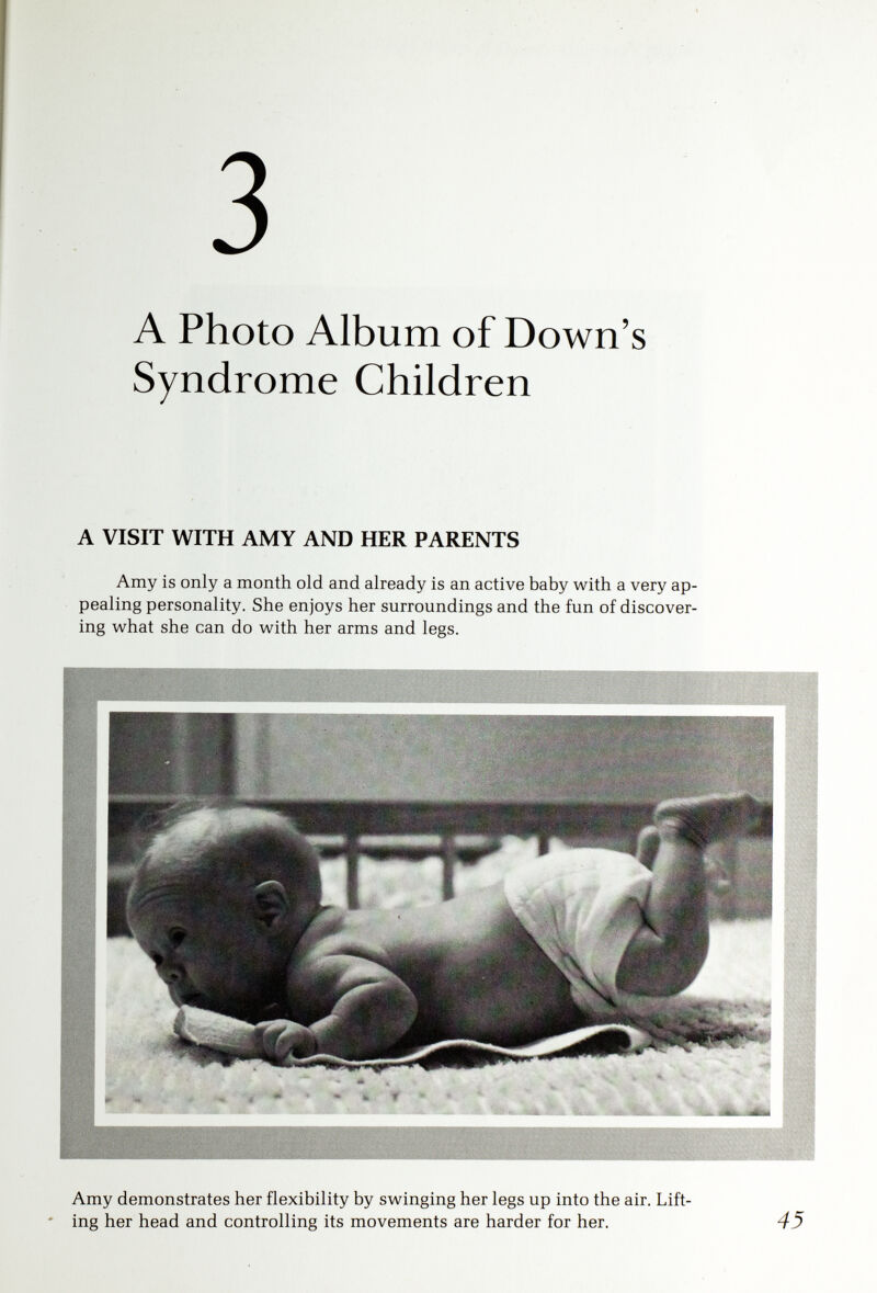 A Photo Album of Down's Syndrome Children A good burp!