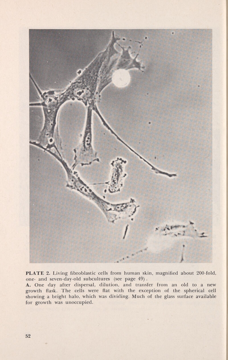 PLATE 2. Living fibroblastic cells from human skin, magnified about 200-fold, one- and seven-day-old subcultures (see page 49) . A. One day after dispersal, dilution, and transfer from an old to a new growth flask. The cells were flat with the exception of the spherical cell showing a bright halo, which was dividing. Much of the glass surface available for growth was unoccupied. 52