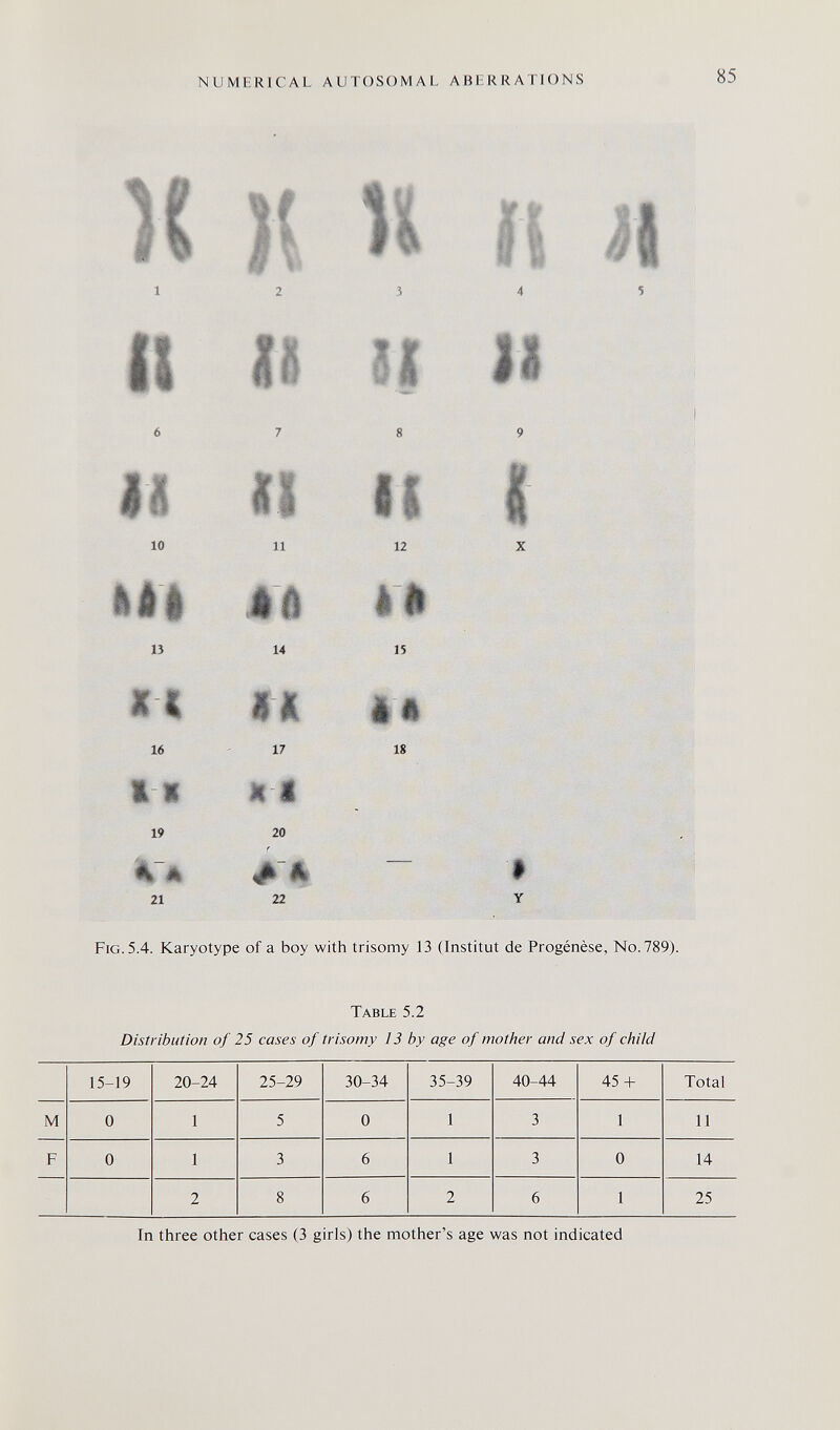 NUMERICAL AUTOSOMAL ABERRATIONS 85 Table 5.2 Distribution of 25 cases of trisomy 13 by age of mother and sex of child In three other cases (3 girls) the mother's age was not indicated