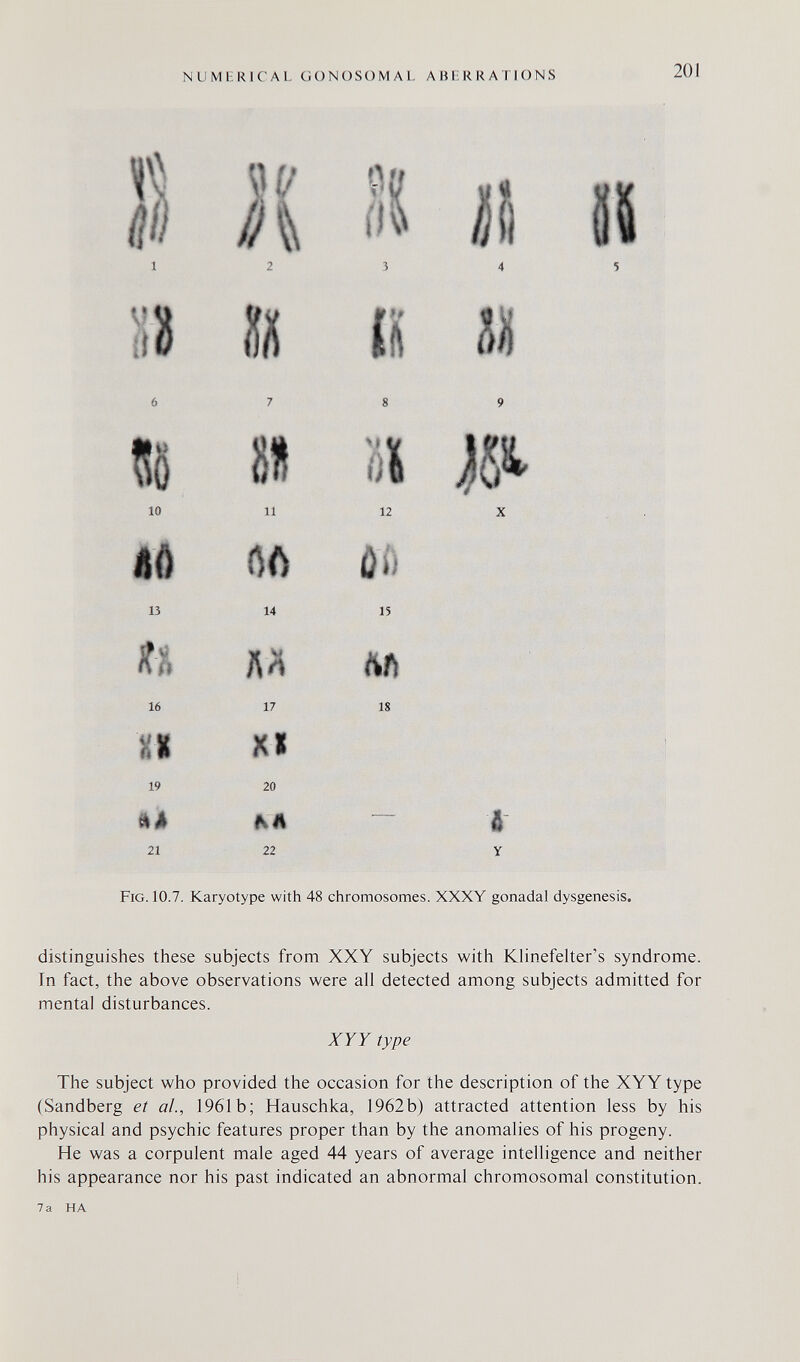 NUMERICAL GONOSOMAL ABERRATIONS 201 10 11 12 X 15 14 15 16 17 18 19 20 21 22 Fig. 10.7. Karyotype with 48 chromosomes. XXXY gonadal dysgenesis. distinguishes these subjects from XXY subjects with Khnefelter's syndrome. In fact, the above observations were all detected among subjects admitted for mental disturbances. Xrr type The subject who provided the occasion for the description of the XYY type (Sandberg et al., 1961b; Hauschka, 1962b) attracted attention less by his physical and psychic features proper than by the anomalies of his progeny. He was a corpulent male aged 44 years of average intelligence and neither his appearance nor his past indicated an abnormal chromosomal constitution. 7a HA