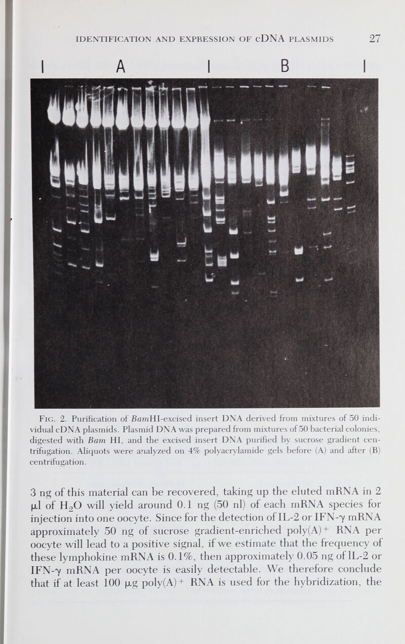 IDENTIFICATION AND EXPRESSION OF cDNA PLASMIDS 27 Fig. 2. Purification of BamHI-excised insert DXA derived from mixtures of 50 indi¬ vidual cDXA plasmids. Plasmid DXA was prepared from mixtures of 50 bacterial colonies, digested with Bam HI, and the excised insert DXA purified by sucrose gradient cen- trifugation. Aliquots were analyzed on 4% Polyacrylamide gels before (A) and after (B) centrifugation. 3 ng of this material can be recovered, taking up the eluted mRNA in 2 fjil of H2O will yield around 0.1 ng (50 nl) of each mRNA species for injection into one oocyte. Since for the detection of IL-2 or IFN-7 mRNA approximately 50 ng of sucrose gradient-enriched poly(A)+ RNA per oocyte will lead to a positive signal, if we estimate that the frequency of these lymphokine mRNA is 0.1%, then approximately 0.05 ng of lL-2 or IFN-7 mRNA per oocyte is easily detectable. We therefore conclude that if at least 100 |xg poly(A)+ RNA is used for the hybridization, the