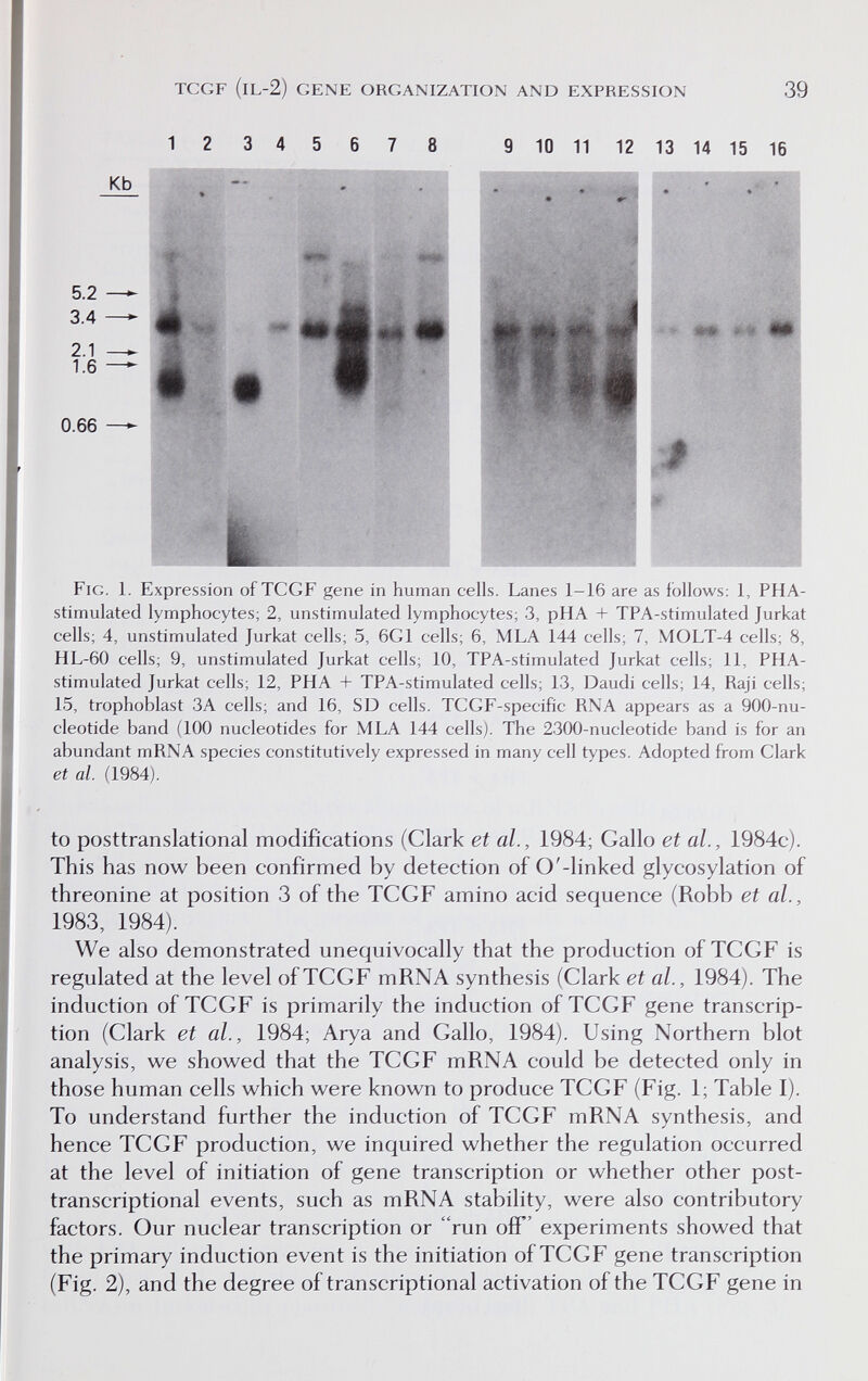 TCGF (IL-2) GENE ORGANIZATION AND EXPRESSION 39 1 2 3 4 5 8 9 10 11 12 13 14 15 16 Kb 5.2 3.4 2.1 1.6 0.66 } # Fig. 1. Expression of TCGF gene in human cells. Lanes 1-16 are as follows: 1, PHA- stimulated lymphocytes; 2, unstimulated lymphocytes; 3, pHA + TPA-stimulated Jurkat cells; 4, unstimulated Jurkat cells; 5, 6G1 cells; 6, MLA 144 cells; 7, MOLT-4 cells; 8, HL-60 cells; 9, unstimulated Jurkat cells; 10, TPA-stimulated Jurkat cells; 11, PHA- stimulated Jurkat cells; 12, PHA + TPA-stimulated cells; 13, Daudi cells; 14, Raji cells; 15, trophoblast ЗА cells; and 16, SD cells. TCGF-specific RNA appears as a 900-nu- cleotide band (100 nucleotides for MLA 144 cells). The 2300-nucleotide band is for an abundant mRNA species constitutively expressed in many cell types. Adopted from Clark et al. (1984). to posttranslational modifications (Clark et al., 1984; Gallo et al., 1984c). This has now been confirmed by detection of О'-linked glycosylation of threonine at position 3 of the TCGF amino acid sequence (Robb et al., 1983, 1984). We also demonstrated unequivocally that the production of TCGF is regulated at the level of TCGF mRNA synthesis (Clark et al., 1984). The induction of TCGF is primarily the induction of TCGF gene transcrip¬ tion (Clark et al., 1984; Arya and Gallo, 1984). Using Northern blot analysis, we showed that the TCGF mRNA could be detected only in those human cells which were known to produce TCGF (Fig. 1; Table I). To understand further the induction of TCGF mRNA synthesis, and hence TCGF production, we inquired whether the regulation occurred at the level of initiation of gene transcription or whether other post- transcriptional events, such as mRNA stability, were also contributory factors. Our nuclear transcription or run off' experiments showed that the primary induction event is the initiation of TCGF gene transcription (Fig. 2), and the degree of transcriptional activation of the TCGF gene in