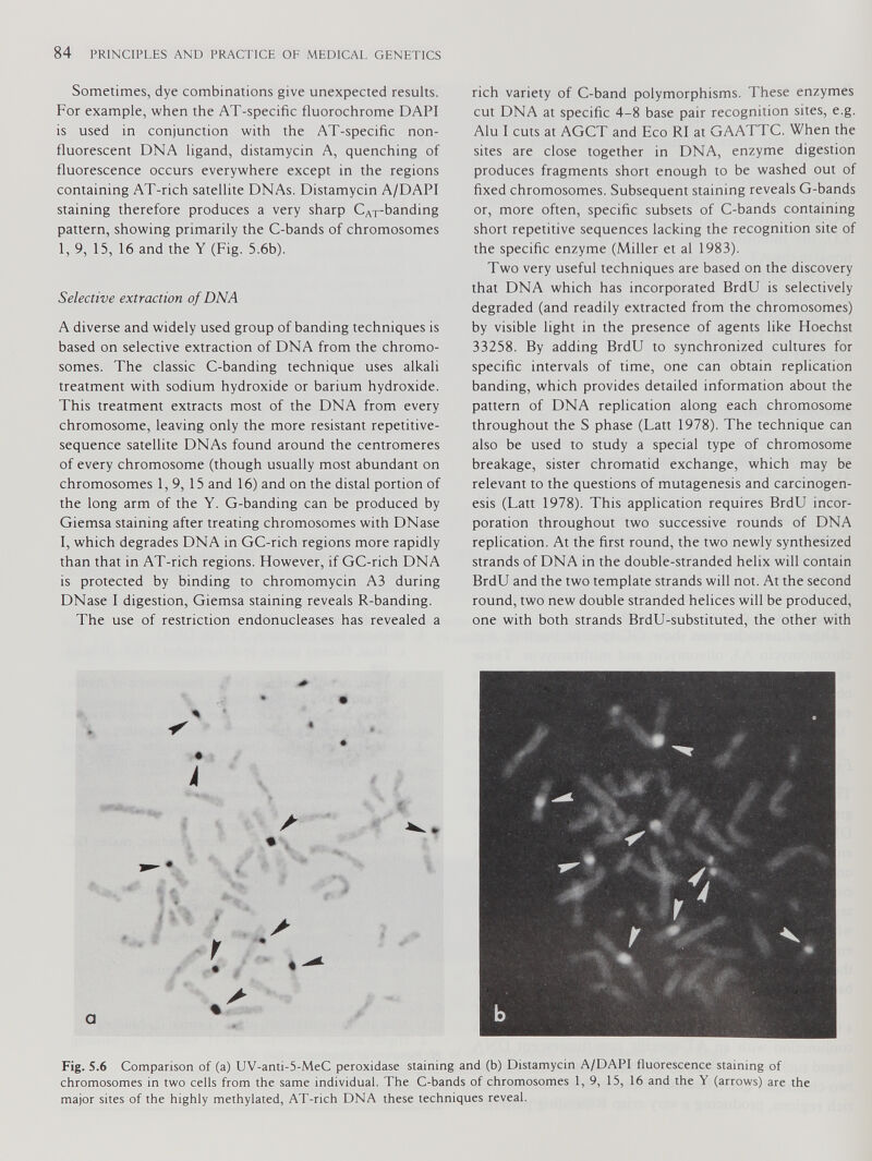 Sometimes, dye combinations give unexpected results. For example, when the AT-specific fluorochrome DAPI is used in conjunction with the AT-specific non- fluorescent DNA ligand, distamycin A, quenching of fluorescence occurs everywhere except in the regions containing AT-rich satellite DNAs. Distamycin A/DAPI staining therefore produces a very sharp C AT -banding pattern, showing primarily the C-bands of chromosomes 1, 9, 15, 16 and the Y (Fig. 5.6b). Selective extraction of DNA A diverse and widely used group of banding techniques is based on selective extraction of DNA from the chromo somes. The classic C-banding technique uses alkali treatment with sodium hydroxide or barium hydroxide. This treatment extracts most of the DNA from every chromosome, leaving only the more resistant repetitive- sequence satellite DNAs found around the centromeres of every chromosome (though usually most abundant on chromosomes 1,9, 15 and 16) and on the distal portion of the long arm of the Y. G-banding can be produced by Giemsa staining after treating chromosomes with DNase I, which degrades DNA in GC-rich regions more rapidly than that in AT-rich regions. However, if GC-rich DNA is protected by binding to chromomycin A3 during DNase I digestion, Giemsa staining reveals R-banding. The use of restriction endonucleases has revealed a rich variety of C-band polymorphisms. These enzymes cut DNA at specific 4-8 base pair recognition sites, e.g. Alu I cuts at AGCT and Eco RI at GAATTC. When the sites are close together in DNA, enzyme digestion produces fragments short enough to be washed out of fixed chromosomes. Subsequent staining reveals G-bands or, more often, specific subsets of C-bands containing short repetitive sequences lacking the recognition site of the specific enzyme (Miller et al 1983). Two very useful techniques are based on the discovery that DNA which has incorporated BrdU is selectively degraded (and readily extracted from the chromosomes) by visible light in the presence of agents like Hoechst 33258. By adding BrdU to synchronized cultures for specific intervals of time, one can obtain replication banding, which provides detailed information about the pattern of DNA replication along each chromosome throughout the S phase (Latt 1978). The technique can also be used to study a special type of chromosome breakage, sister chromatid exchange, which may be relevant to the questions of mutagenesis and carcinogen esis (Latt 1978). This application requires BrdU incor poration throughout two successive rounds of DNA replication. At the first round, the two newly synthesized strands of DNA in the double-stranded helix will contain BrdU and the two template strands will not. At the second round, two new double stranded helices will be produced, one with both strands BrdU-substituted, the other with Fig. 5.6 Comparison of (a) UV-anti-5-MeC peroxidase staining and (b) Distamycin A/DAPI fluorescence staining of chromosomes in two cells from the same individual. The C-bands of chromosomes 1, 9, 15, 16 and the Y (arrows) are the major sites of the highly methylated, AT-rich DNA these techniques reveal.