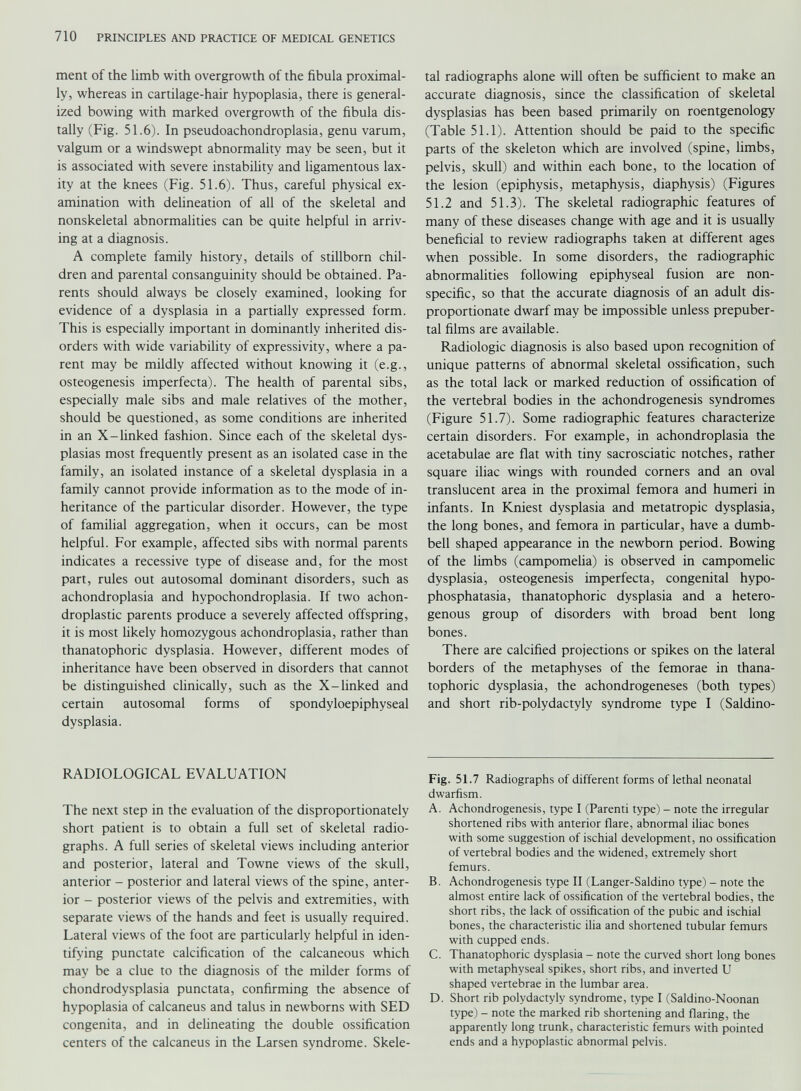 ment of the limb with overgrowth of the fibula proximal- ly, whereas in cartilage-hair hypoplasia, there is general ized bowing with marked overgrowth of the fibula dis- tally (Fig. 51.6). In pseudoachondroplasia, genu varum, valgum or a windswept abnormality may be seen, but it is associated with severe instability and ligamentous lax ity at the knees (Fig. 51.6). Thus, careful physical ex amination with delineation of all of the skeletal and nonskeletal abnormalities can be quite helpful in arriv ing at a diagnosis. A complete family history, details of stillborn chil dren and parental consanguinity should be obtained. Pa rents should always be closely examined, looking for evidence of a dysplasia in a partially expressed form. This is especially important in dominantly inherited dis orders with wide variability of expressivity, where a pa rent may be mildly affected without knowing it (e.g., osteogenesis imperfecta). The health of parental sibs, especially male sibs and male relatives of the mother, should be questioned, as some conditions are inherited in an X-linked fashion. Since each of the skeletal dys plasias most frequently present as an isolated case in the family, an isolated instance of a skeletal dysplasia in a family cannot provide information as to the mode of in heritance of the particular disorder. However, the type of familial aggregation, when it occurs, can be most helpful. For example, affected sibs with normal parents indicates a recessive type of disease and, for the most part, rules out autosomal dominant disorders, such as achondroplasia and hypochondroplasia. If two achon droplastic parents produce a severely affected offspring, it is most likely homozygous achondroplasia, rather than thanatophoric dysplasia. However, different modes of inheritance have been observed in disorders that cannot be distinguished clinically, such as the X-linked and certain autosomal forms of spondyloepiphyseal dysplasia. RADIOLOGICAL EVALUATION The next step in the evaluation of the disproportionately short patient is to obtain a full set of skeletal radio graphs. A full series of skeletal views including anterior and posterior, lateral and Towne views of the skull, anterior - posterior and lateral views of the spine, anter ior - posterior views of the pelvis and extremities, with separate views of the hands and feet is usually required. Lateral views of the foot are particularly helpful in iden tifying punctate calcification of the calcaneous which may be a clue to the diagnosis of the milder forms of chondrodysplasia punctata, confirming the absence of hypoplasia of calcaneus and talus in newborns with SED congenita, and in delineating the double ossification centers of the calcaneus in the Larsen syndrome. Skele tal radiographs alone will often be sufficient to make an accurate diagnosis, since the classification of skeletal dysplasias has been based primarily on roentgenology (Table 51.1). Attention should be paid to the specific parts of the skeleton which are involved (spine, limbs, pelvis, skull) and within each bone, to the location of the lesion (epiphysis, metaphysis, diaphysis) (Figures 51.2 and 51.3). The skeletal radiographic features of many of these diseases change with age and it is usually beneficial to review radiographs taken at different ages when possible. In some disorders, the radiographic abnormalities following epiphyseal fusion are non specific, so that the accurate diagnosis of an adult dis proportionate dwarf may be impossible unless prepuber tal films are available. Radiologic diagnosis is also based upon recognition of unique patterns of abnormal skeletal ossification, such as the total lack or marked reduction of ossification of the vertebral bodies in the achondrogenesis syndromes (Figure 51.7). Some radiographic features characterize certain disorders. For example, in achondroplasia the acetabulae are flat with tiny sacrosciatic notches, rather square iliac wings with rounded corners and an oval translucent area in the proximal femora and humeri in infants. In Kniest dysplasia and metatropic dysplasia, the long bones, and femora in particular, have a dumb bell shaped appearance in the newborn period. Bowing of the limbs (campomelia) is observed in campomelic dysplasia, osteogenesis imperfecta, congenital hypo- phosphatasia, thanatophoric dysplasia and a hetero genous group of disorders with broad bent long bones. There are calcified projections or spikes on the lateral borders of the metaphyses of the femorae in thana tophoric dysplasia, the achondrogeneses (both types) and short rib-polydactyly syndrome type I (Saldino- Fig. 51.7 Radiographs of different forms of lethal neonatal dwarfism. A. Achondrogenesis, type I (Parenti type) - note the irregular shortened ribs with anterior flare, abnormal iliac bones with some suggestion of ischial development, no ossification of vertebral bodies and the widened, extremely short femurs. B. Achondrogenesis type II (Langer-Saldino type) - note the almost entire lack of ossification of the vertebral bodies, the short ribs, the lack of ossification of the pubic and ischial bones, the characteristic ilia and shortened tubular femurs with cupped ends. C. Thanatophoric dysplasia - note the curved short long bones with metaphyseal spikes, short ribs, and inverted U shaped vertebrae in the lumbar area. D. Short rib polydactyly syndrome, type I (Saldino-Noonan type) - note the marked rib shortening and flaring, the apparently long trunk, characteristic femurs with pointed ends and a hypoplastic abnormal pelvis.
