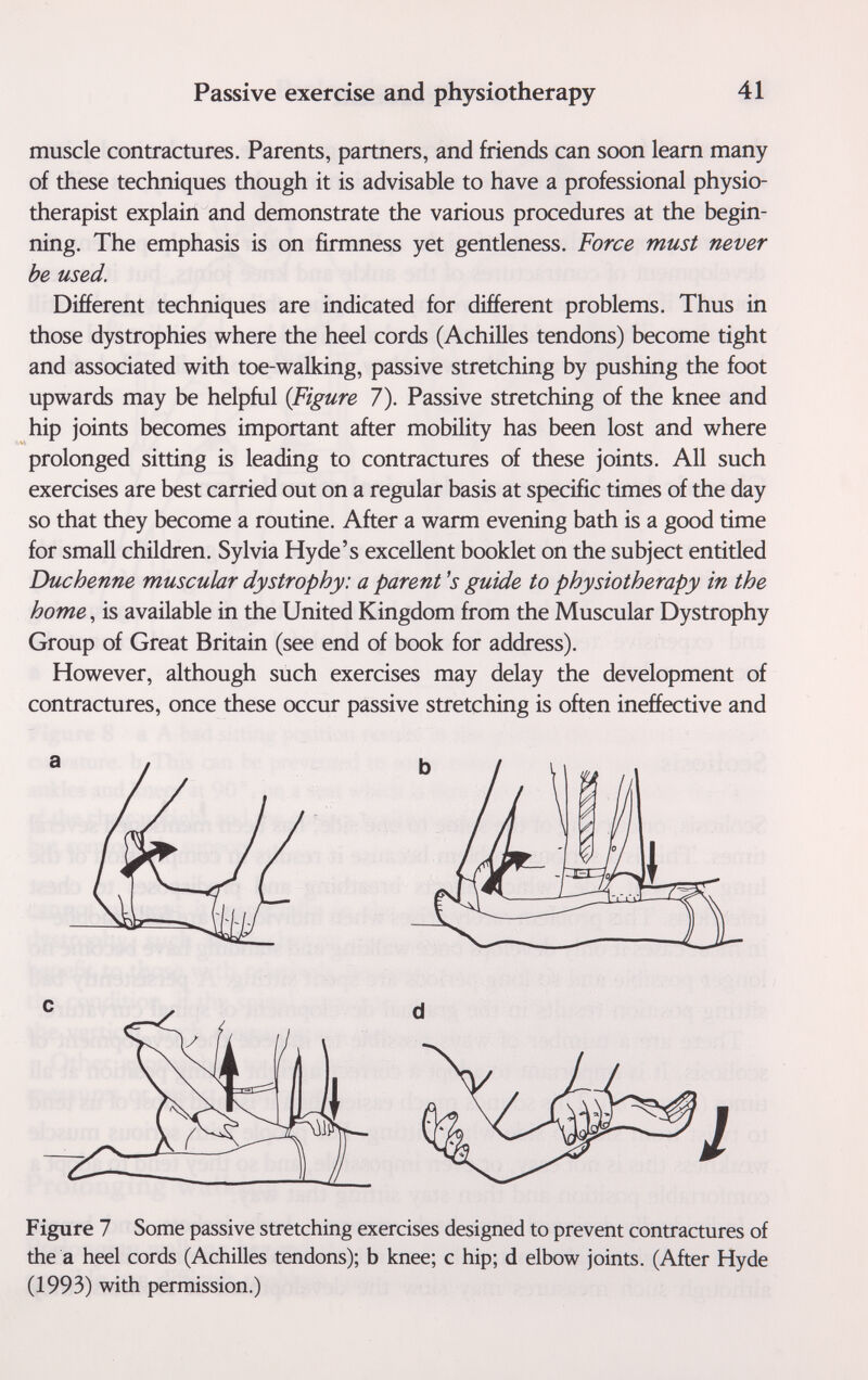 Passive exercise and physiotherapy 41 muscle contractures. Parents, partners, and friends can soon learn many of these techniques though it is advisable to have a professional physio¬ therapist explain and demonstrate the various procedures at the begin¬ ning. The emphasis is on firmness yet gentleness. Force must never be used. Different techniques are indicated for different problems. Thus in those dystrophies where the heel cords (Achilles tendons) become tight and associated with toe-walking, passive stretching by pushing the foot upwards may be helpful {Figure 7). Passive stretching of the knee and hip joints becomes important after mobility has been lost and where prolonged sitting is leading to contractures of these joints. All such exercises are best carried out on a regular basis at specific times of the day so that they become a routine. After a warm evening bath is a good time for small children. Sylvia Hyde's excellent booklet on the subject entitled Duchenne muscular dystrophy: a parent's guide to physiotherapy in the home, is available in the United Kingdom from the Muscular Dystrophy Group of Great Britain (see end of book for address). However, although such exercises may delay the development of contractures, once these occur passive stretching is often ineffective and a с d Figure 7 Some passive stretching exercises designed to prevent contractures of the a heel cords (Achilles tendons); b knee; с hip; d elbow joints. (After Hyde (1993) with permission.)