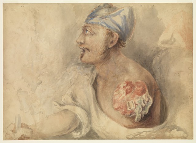 digitised image 1