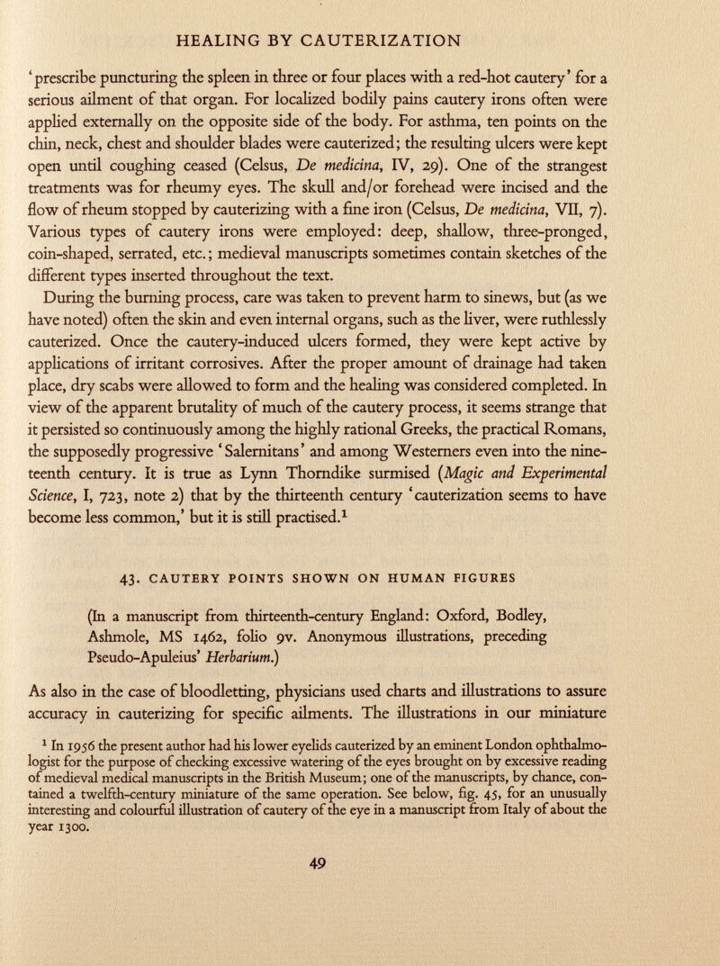 'prescribe puncturing the spleen in three or four places with a red-hot cautery' for a serious ailment of that organ. For localized bodily pains cautery irons often were applied externally on the opposite side of the body. For asthma, ten points on the chin, neck, chest and shoulder blades were cauterized; the resulting ulcers were kept open until coughing ceased (Celsus, De medicina , IV, 29). One of the strangest treatments was for rheumy eyes. The skull and/or forehead were incised and the flow of rheum stopped by cauterizing with a fine iron (Celsus, De medicina, VII, 7). Various types of cautery irons were employed: deep, shallow, three-pronged, coin-shaped, serrated, etc. ; medieval manuscripts sometimes contain sketches of the different types inserted throughout the text. During the burning process, care was taken to prevent harm to sinews, but (as we have noted) often the skin and even internal organs, such as the liver, were ruthlessly cauterized. Once the cautery-induced ulcers formed, they were kept active by applications of irritant corrosives. After the proper amount of drainage had taken place, dry scabs were allowed to form and the healing was considered completed. In view of the apparent brutality of much of the cautery process, it seems strange that it persisted so continuously among the highly rational Greeks, the practical Romans, the supposedly progressive ' Salernitans' and among Westerners even into the nine teenth century. It is true as Lynn Thorndike surmised (Magic and Experimental Science , I, 723, note 2) that by the thirteenth century 'cauterization seems to have become less common,' but it is still practised. 1 43. cautery points shown on human figures (In a manuscript from thirteenth-century England: Oxford, Bodley, Ashmole, MS 1462, folio 9V. Anonymous illustrations, preceding Pseudo-Apuleius' Herbarium.) As also in the case of bloodletting, physicians used charts and illustrations to assure accuracy in cauterizing for specific ailments. The illustrations in our miniature 1 In 1956 the present author had his lower eyelids cauterized by an eminent London ophthalmo logist for the purpose of checking excessive watering of the eyes brought on by excessive reading of medieval medical manuscripts in the British Museum; one of the manuscripts, by chance, con tained a twelfth-century miniature of the same operation. See below, fig. 45, for an unusually interesting and colourful illustration of cautery of the eye in a manuscript from Italy of about the year 1300.