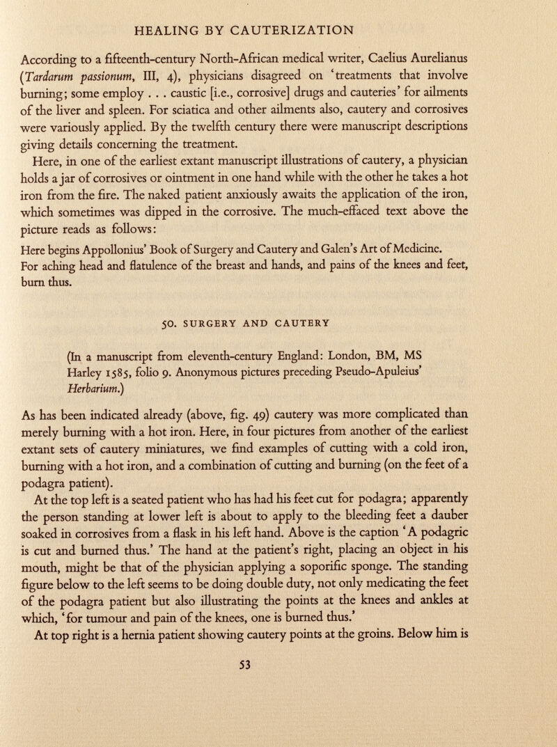 According to a fifteenth-century North-African medical writer, Caelius Aurelianus (Tardarum passionum, III, 4), physicians disagreed on 'treatments that involve burning; some employ . . . caustic [i.e., corrosive] drugs and cauteries' for ailments of the liver and spleen. For sciatica and other ailments also, cautery and corrosives were variously applied. By the twelfth century there were manuscript descriptions giving details concerning the treatment. Here, in one of the earliest extant manuscript illustrations of cautery, a physician holds a jar of corrosives or ointment in one hand while with the other he takes a hot iron from the fire. The naked patient anxiously awaits the application of the iron, which sometimes was dipped in the corrosive. The much-effaced text above the picture reads as follows: Here begins Appollonius' Book of Surgery and Cautery and Galen's Art of Medicine. For aching head and flatulence of the breast and hands, and pains of the knees and feet, burn thus. 50. surgery and cautery (In a manuscript from eleventh-century England: London, BM, MS Harley 1585, folio 9. Anonymous pictures preceding Pseudo-Apuleius' Herbarium.) As has been indicated already (above, fig. 49) cautery was more complicated than merely burning with a hot iron. Here, in four pictures from another of the earliest extant sets of cautery miniatures, we find examples of cutting with a cold iron, burning with a hot iron, and a combination of cutting and burning (on the feet of a podagra patient). At the top left is a seated patient who has had his feet cut for podagra; apparently the person standing at lower left is about to apply to the bleeding feet a dauber soaked in corrosives from a flask in his left hand. Above is the caption ' A podagric is cut and burned thus.' The hand at the patient's right, placing an object in his mouth, might be that of the physician applying a soporific sponge. The standing figure below to the left seems to be doing double duty, not only medicating the feet of the podagra patient but also illustrating the points at the knees and ankles at which, 'for tumour and pain of the knees, one is burned thus.' At top right is a hernia patient showing cautery points at the groins. Below him is