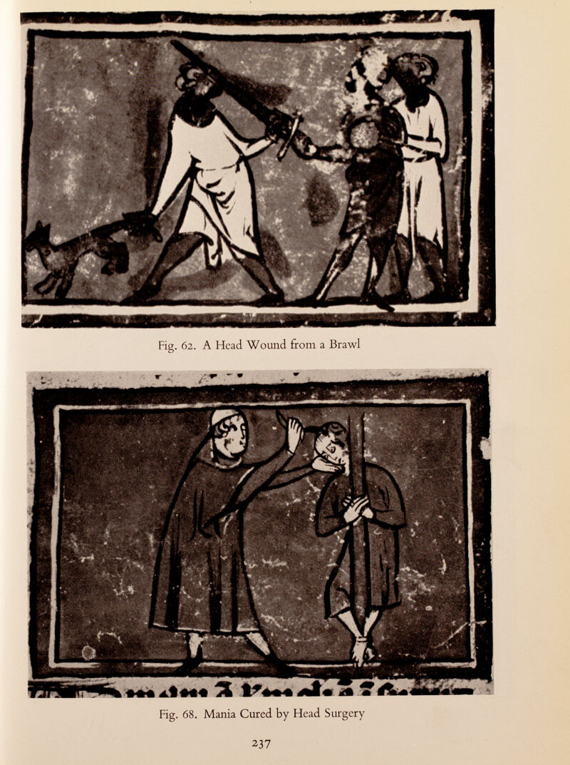 Fig. 62. A Head Wound from a Brawl Fig. 68. Mania Cured by Head Surgery 237