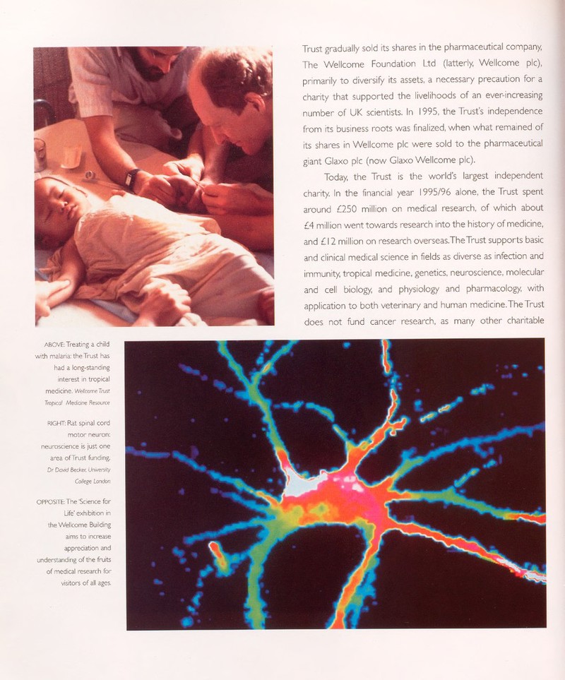 Trust gradually sold its shares in the pharmaceutical company; The Wellcome Foundation Ltd (latterly, Wellcome pic), primarily to diversify Its assets, a necessary precaution for a charity that supported the livelihoods of an ever-increasing number of UK scientists. In 1995, the Trust's independence from Its business roots was finalized, when what remained of Its shares in Wellcome pic were sold to the pharmaceutical giant Glaxo pic (now Glaxo Wellcome pic). Today, the Trust is the world's largest independent charity. In the financial year 1995/96 alone, the Trust spent around £250 million on medical research, of which about £4 million went towards research into the history of medicine, and £12 million on research overseas.TheTrust supports basic and clinical medical science in fields as diverse as infection and immunity, tropical medicine, genetics, neuroscience, molecular and cell biology, and physiology and pharmacology, with application to both veterinary and human medicine.The Trust does, not fund cancer research, as many other charitable ABOVE: Treating a child with malaria: the Trust has had a long-standing interest in tropical medicine. Wellcome Trust Tropical Medicine Resource RIGHT: Rat spinal cord motor neuron: neuroscience is just one area ofTrust funding. Dr David Becker, University College London OPPOSITE: The 'Science for Life' exhibition in the Wellcome Building aims to increase appreciation and understanding of the fruits of medical research for visitors of all ages.