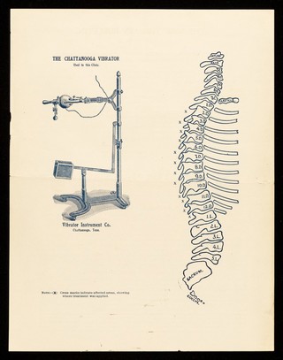 The new therapy bulletin. Bulletin no. 2 / Clinical Department of the Chattanooga Vibrator Instrument Company.
