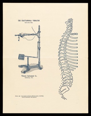 The new therapy bulletin. Bulletin no. 17 / Clinical Department of The Vibrator Instrument Company.