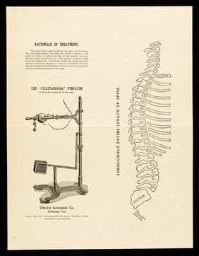 Bulletin. No. 30, Muscular rheumatism / Clinical Department of The Vibrator Instrument Company.