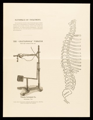 Bulletin. No. 31, Albuminuria / Clinical Department of The Vibrator Instrument Company.