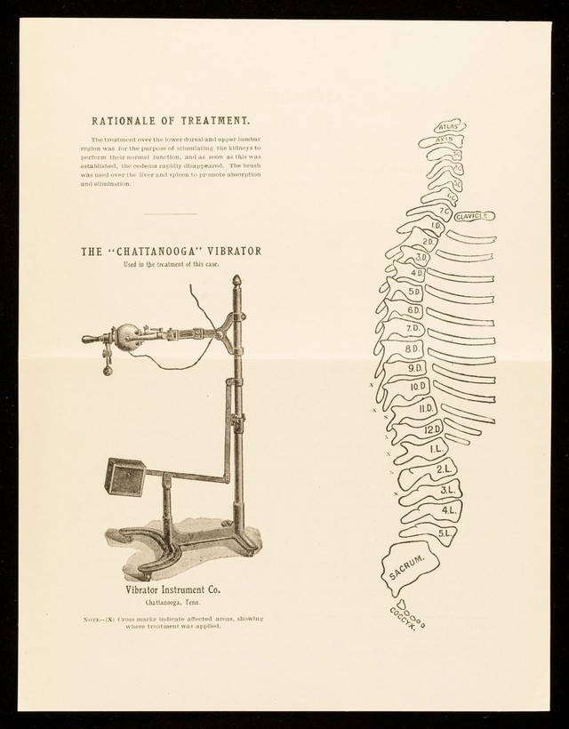 digitised image 2