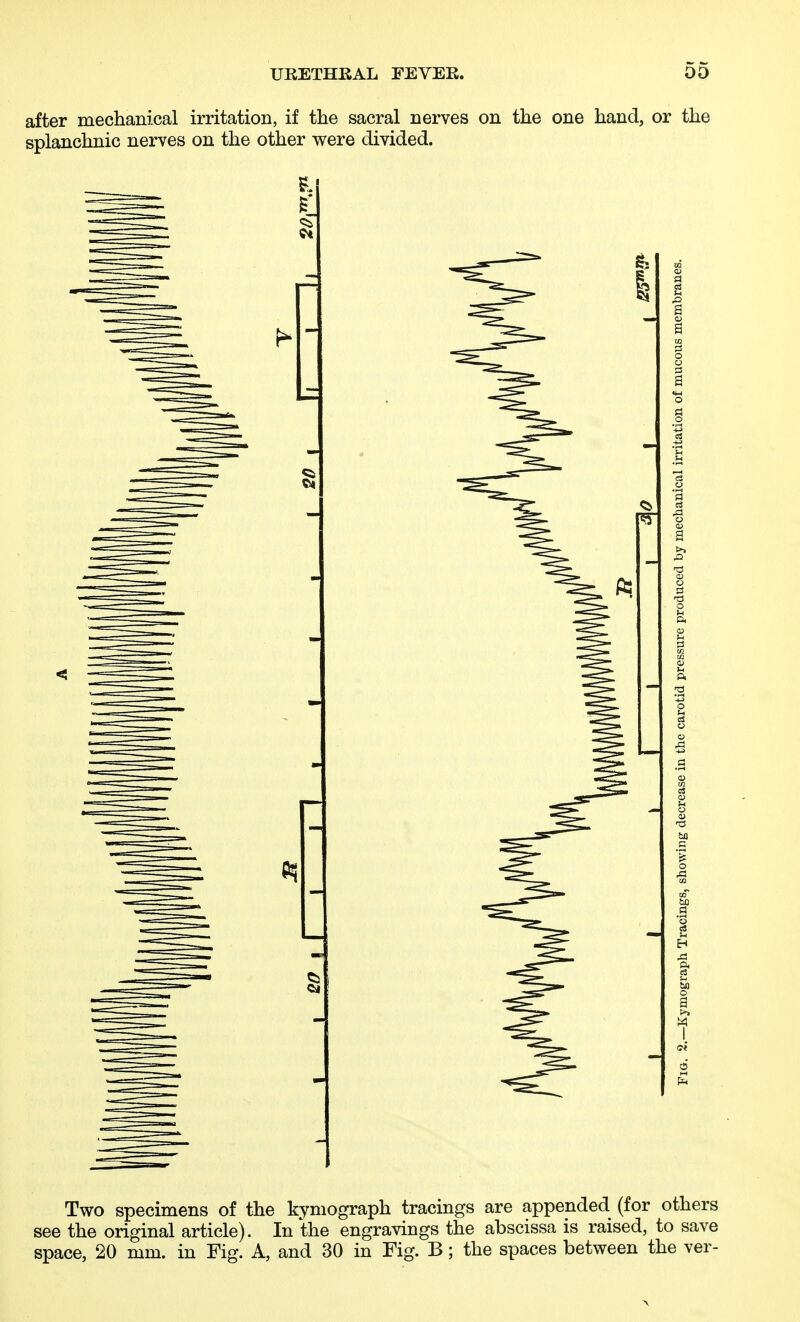 after mechanical irritation, if the sacral nerves on the one hand, or the splanchnic nerves on the other were divided. Two specimens of the kymograph tracings are appended (for others see the original article). In the engravings the abscissa is raised, to save space, 20 mm. in Fig. A, and 30 in Fig. B; the spaces between the ver-