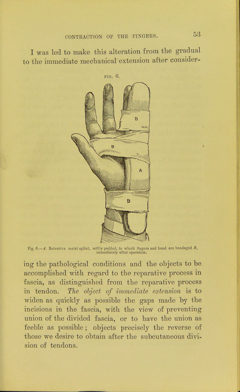 I was led to make this alteration from the gradual to the immediate mechanical extension after consider- FIG. 6. Fig. 6.~J. Retentive metal splint, softly padded, to wliich fingers and hand are bandaged S, immediately after operation. ing the pathological conditions and the objects to be accomplished with regard to the reparative process in fascia, as distinguished from the reparative process in tendon. The object of immediate extension is to widen as quickly as possible the gaps made by the incisions in the fascia, with the view of preventing union of the divided fascia, or to have the union as feeble as possible; objects precisely the reverse of those we desire to obtain after the subcutaneous divi- sion of tendons.
