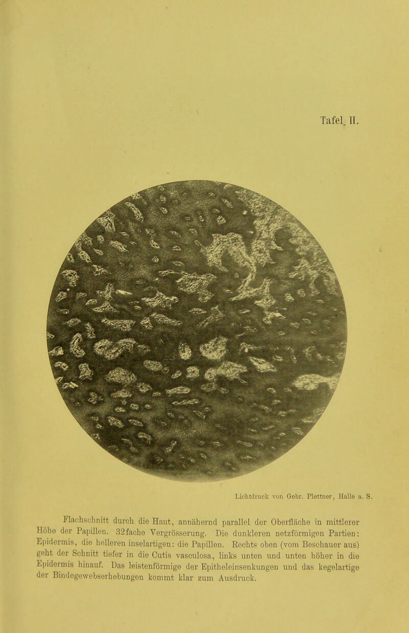 Lichtdruck von Gebr. Plettiier, Halle a. S. Flachschnitt durch die Haut, annähernd parallel der Oberfläche in mittlerer Höhe der Papillen, 32fache Vergrösserung. Die dunkleren netzförmigen Partien: Epidermis, die holleren inselartigen: die Papillen. Rechts oben (vom Beschauer aus) geht der Schnitt tiefer in die Cutis vasculosa, links unten und unten höher in die Epidermis hinauf. Das leistenförmige der Epitheleinsenkungen und das kegelartige der Bindegewebserhebungen kommt klar zum Ausdruck.