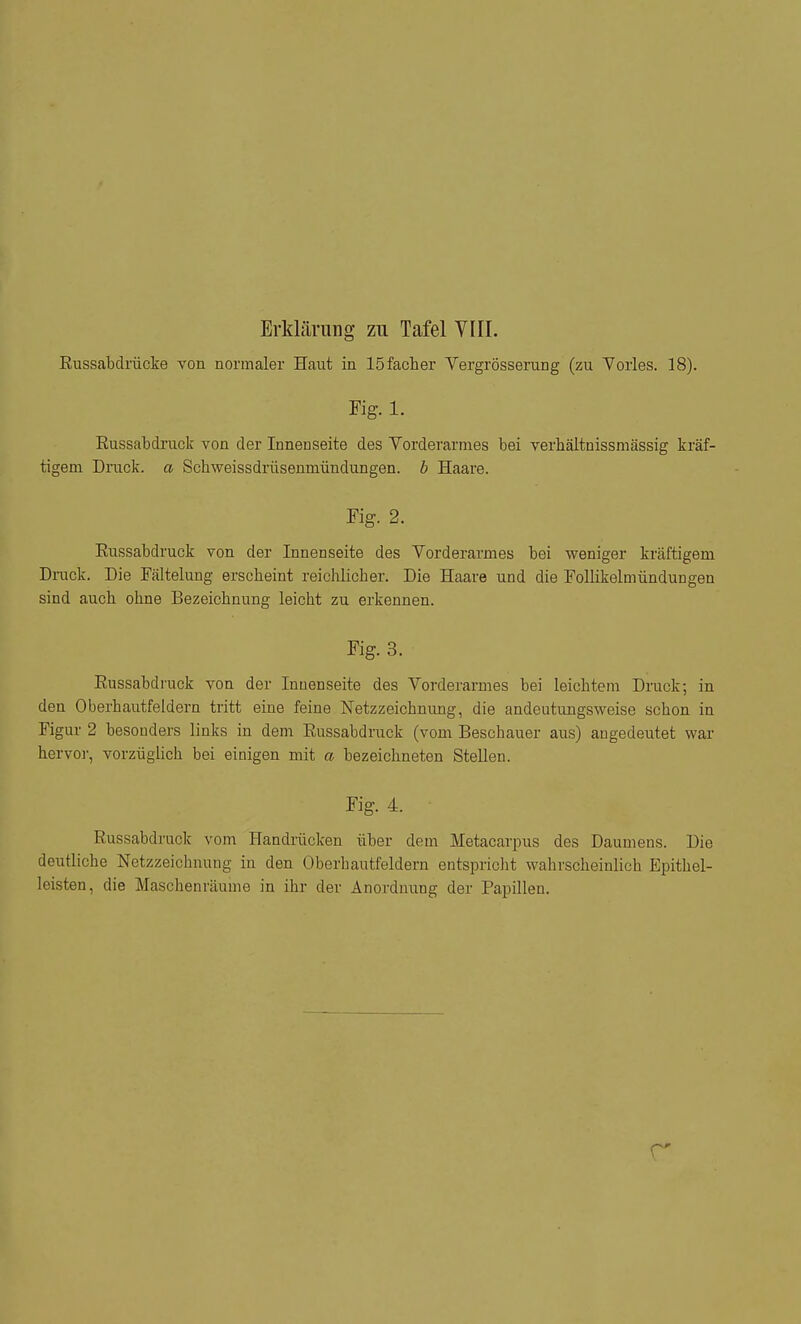 Eussabdrücke von normaler Haut in löfacher Vergrösserung (zu Vorlas. 18). Kg. 1. Eussabdi'uck von der Innenseite des Vorderarmes bei verhältnissmässig kräf- tigem Druck, a Schweissdrüsenmündungen. b Haare. Fig. 2. Eussabdruck von der Innenseite des Vorderarmes bei weniger kräftigem Druck. Die Fältelung erscheint reichlicher. Die Haare und die Follikelmündungen sind auch ohne Bezeichnung leicht zu erkennen. Fig. 3. Eussabdruck von der Innenseite des Vorderarmes bei leichtem Druck; in den Oberhautfeldera tritt eine feine Netzzeichnung, die andeutungsweise schon in Figur 2 besonders links in dem Eussabdruck (vom Beschauer aus) angedeutet war hervor, vorzüglich bei einigen mit a bezeichneten Stellen. Fig. 4. Eussabdruck vom Handrücken über dem Metacarpus des Daumens. Die deutliche Netzzeichnung in den Oberhautfeldern entspricht wahrscheinlich Epithel- leisten, die Maschenräume in ihr der Anordnung der Papillen.