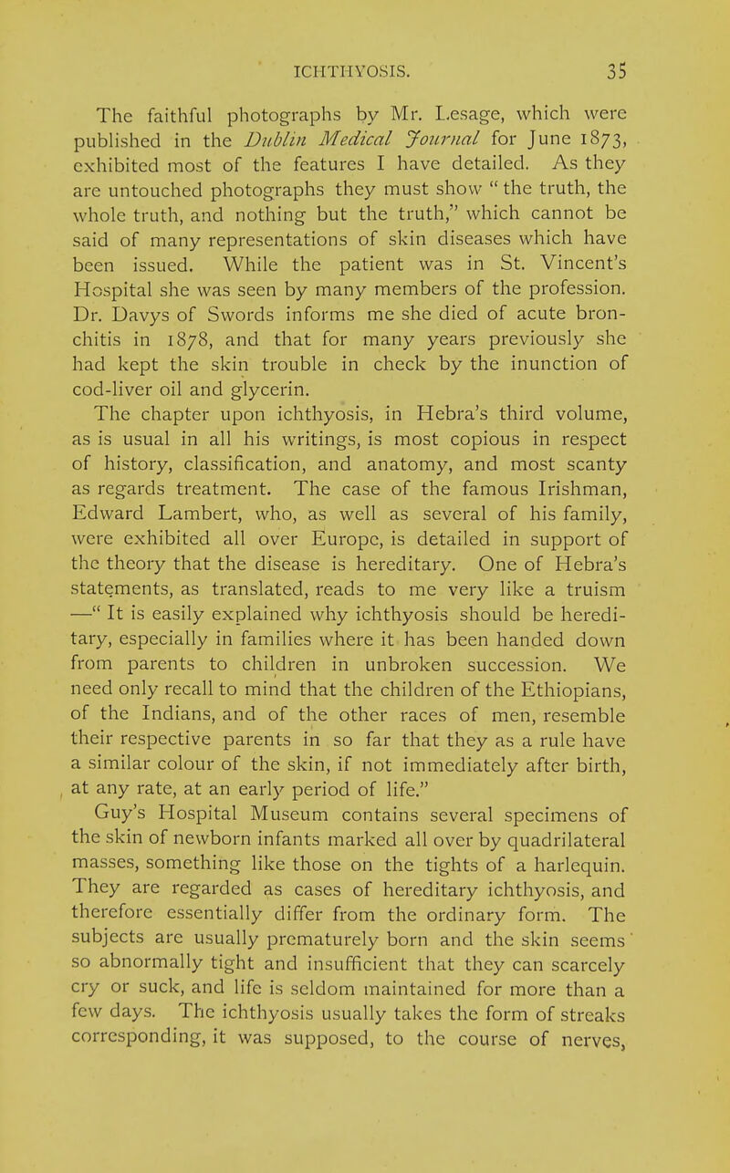 The faithful photographs by Mr. Lesage, which were published in the Dublin Medical Journal for June 1873, exhibited most of the features I have detailed. As they are untouched photographs they must show  the truth, the whole truth, and nothing but the truth, which cannot be said of many representations of skin diseases which have been issued. While the patient was in St. Vincent's Hospital she was seen by many members of the profession. Dr. Davys of Swords informs me she died of acute bron- chitis in 1878, and that for many years previously she had kept the skin trouble in check by the inunction of cod-liver oil and glycerin. The chapter upon ichthyosis, in Hebra's third volume, as is usual in all his waitings, is most copious in respect of history, classification, and anatomy, and most scanty as regards treatment. The case of the famous Irishman, Edward Lambert, who, as well as several of his family, were exhibited all over Europe, is detailed in support of the theory that the disease is hereditary. One of Hebra's statements, as translated, reads to me very like a truism — It is easily explained why ichthyosis should be heredi- tary, especially in families where it has been handed down from parents to children in unbroken succession. We need only recall to mind that the children of the Ethiopians, of the Indians, and of the other races of men, resemble their respective parents in so far that they as a rule have a similar colour of the skin, if not immediately after birth, at any rate, at an early period of life. Guy's Hospital Museum contains several specimens of the skin of newborn infants marked all over by quadrilateral masses, something like those on the tights of a harlequin. They are regarded as cases of hereditary ichthyosis, and therefore essentially differ from the ordinary form. The subjects are usually prematurely born and the skin seems * so abnormally tight and insufficient that they can scarcely cry or suck, and life is seldom maintained for more than a few days. The ichthyosis usually takes the form of streaks corresponding, it was supposed, to the course of nerves,