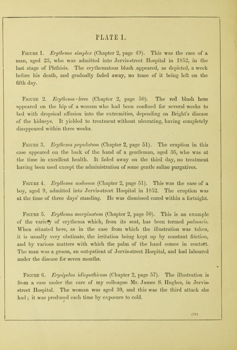 Figure 1. Erythema sijnplex (Chapter 2, page 49). This was the case of a man, aged 23, who was admitted into Jervis-street Hospital in 1852, in the last stage of Phthisis. The erythematous blush .appeared, as depicted, a week before his death, and gradually faded away, no trace of it being left on the fifth day. Figure 2. Erythema-lave (Chapter 2, page 50). The red blush here appeared on the hip of a woman who had been confined for several weeks to bed with dropsical effusion into the extremities, depending on Bright's disease of the kidneys. It yielded to treatment without ulcerating, having completely disappeared within three weeks. Figure 3. Erythema papulatum (Chapter 2, page 51). The eruption in this case appeared on the back of the hand of a gentleman, aged 36, who was at the time in excellent health. It faded away on the third day, no treatment having been used except the administration of some gentle saline purgatives. Figure 4. Erythema nodosum (Chapter 2, page 51). This was the case of a boy, aged 9, admitted into Jervis-street Hospital in 1852. The eruption was at the time of three days' standing. He was dismissed cured within a fortnight. Figure 5. Erythema marginatum (Chapter 2, page 50). This is an example of the variety of erythema which, from its seat, has been termed palmaris. When situated here, as in the case from which the illustration was taken, it is usually very obstinate, the irritation being kept up by constant friction, and by various matters with which the palm of the hand comes in contact. The man was a groom, an out-patient of Jervis-street Hospital, and had laboured under the disease for seven months. Figure 6. Erysij^las idiopathicum (Chapter 2, page 57). The illustration is from a case under the care of my colleague Mr. James S. Hughes, in Jervis- street Hospital. The woman was aged 30, and this was the third attack she had ; it was produced each time by exposure to cold.