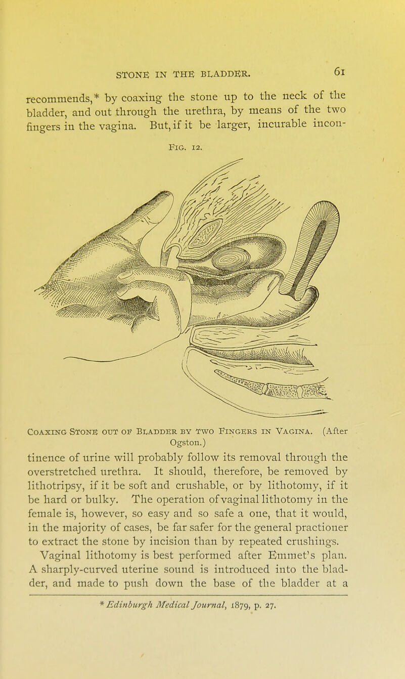 STONE IN THE BLADDER. recommends,* by coaxing the stone up to the neck of the bladder, and out through the urethra, by means of the two fingers in the vagina. But, if it be larger, incurable incon- FlG. 12. Coaxing Stone out op Bladder by two Fingers in Vagina. (After Ogston.) tinence of urine will probably follow its removal through the overstretched urethra. It should, therefore, be removed by lithotripsy, if it be soft and crushable, or by lithotomy, if it be hard or bulky. The operation of vaginal lithotomy in the female is, however, so easy and so safe a one, that it would, in the majority of cases, be far safer for the general practiouer to extract the stone by incision than by repeated crushings. Vaginal lithotomy is best performed after Emmet's plan. A sharply-curved uterine sound is introduced into the blad- der, and made to push down the base of the bladder at a * Edinburgh Medical Journal, 1879, P- 27-