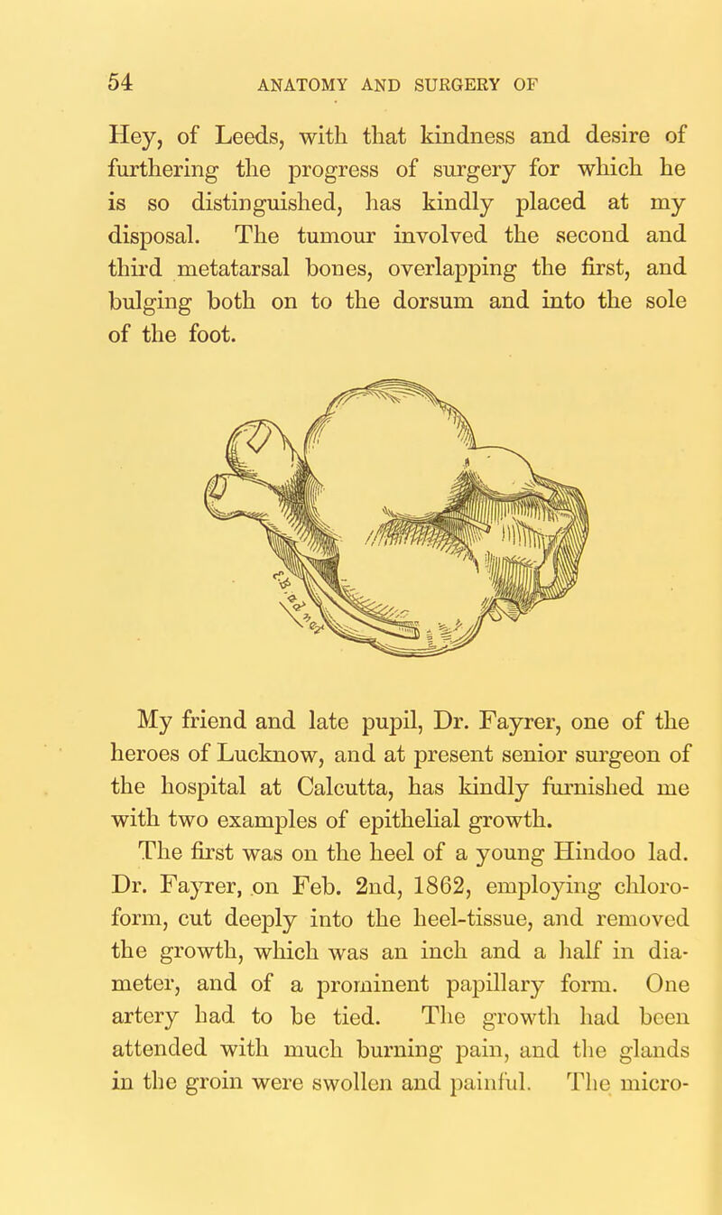 Hey, of Leeds, with that kindness and desire of furthering the progress of surgery for which he is so distinguished, has kindly placed at my disposal. The tumour involved the second and third metatarsal bones, overlapping the first, and bulging both on to the dorsum and into the sole of the foot. My friend and late pupil, Dr. Fayrer, one of the heroes of Lucknow, and at present senior surgeon of the hospital at Calcutta, has kindly furnished me with two examples of epithelial growth. The first was on the heel of a young Hindoo lad. Dr. Fayrer, on Feb. 2nd, 1862, employing chloro- form, cut deeply into the heel-tissue, and removed the growth, which was an inch and a lialf in dia- meter, and of a prominent papillary form. One artery had to be tied. The growtli had been attended with much burning pain, and the glands in the groin were swollen and painful. The micro-