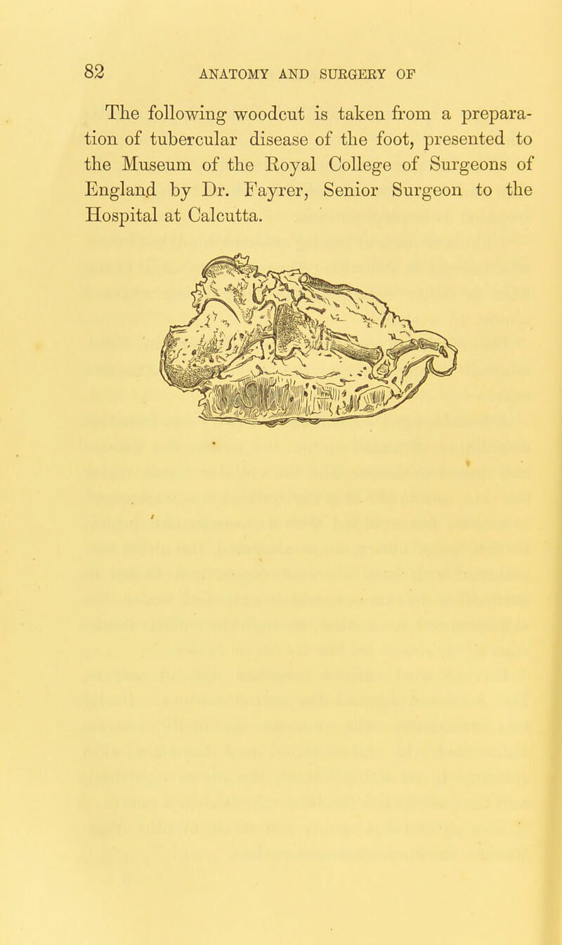 The following woodcut is taken from a prepara- tion of tubercular disease of tlie foot, presented to the Museum of the Royal College of Surgeons of Englan.d by Dr. Fayrer, Senior Surgeon to the Hospital at Calcutta.