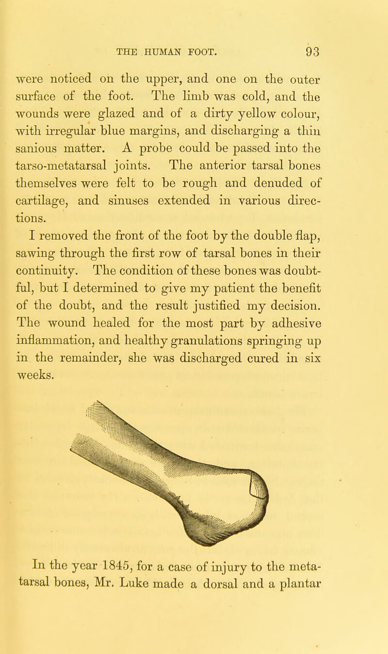 were noticed on the upper, and one on the outer surface of the foot. The limb was cold, and the wounds were glazed and of a dirty yellow colour, with irregular blue margins, and discharging a thin sanious matter. A probe could be passed into the tarso-metatarsal joints. The anterior tarsal bones themselves were felt to be rough and denuded of cartilage, and sinuses extended in various direc- tions. I removed the front of the foot by the double flap, sawing through the first row of tarsal bones in their continuity. The condition of these bones was doubt- ful, but I determined to give my patient the benefit of the doubt, and the result justified my decision. The wound healed for the most part by adhesive inflammation, and healthy granulations springing up in the remainder, she was discharged cured in six weeks. In the year 1845, for a case of injury to the meta- tarsal bones, Mr. Luke made a dorsal and a plantar