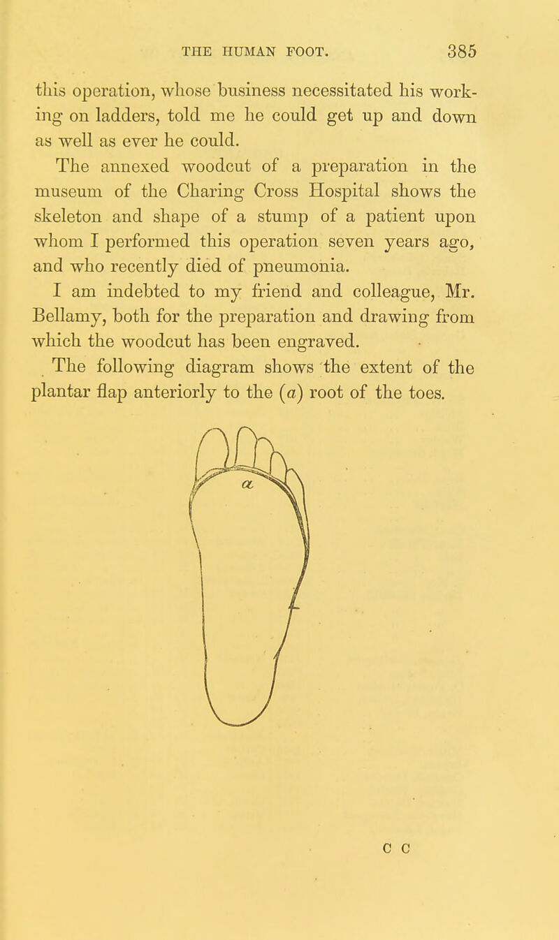 this operation, whose business necessitated his work- ing on ladders, told me he could get up and down as well as ever he could. The annexed woodcut of a preparation in the museum of the Charing Cross Hospital shows the skeleton and shape of a stump of a patient upon whom I performed this operation seven years ago, and who recently died of pneumonia. I am indebted to my friend and colleague, Mr. Bellamy, both for the preparation and drawing from which the woodcut has been engraved. The following diagram shows the extent of the plantar flap anteriorly to the (a) root of the toes.