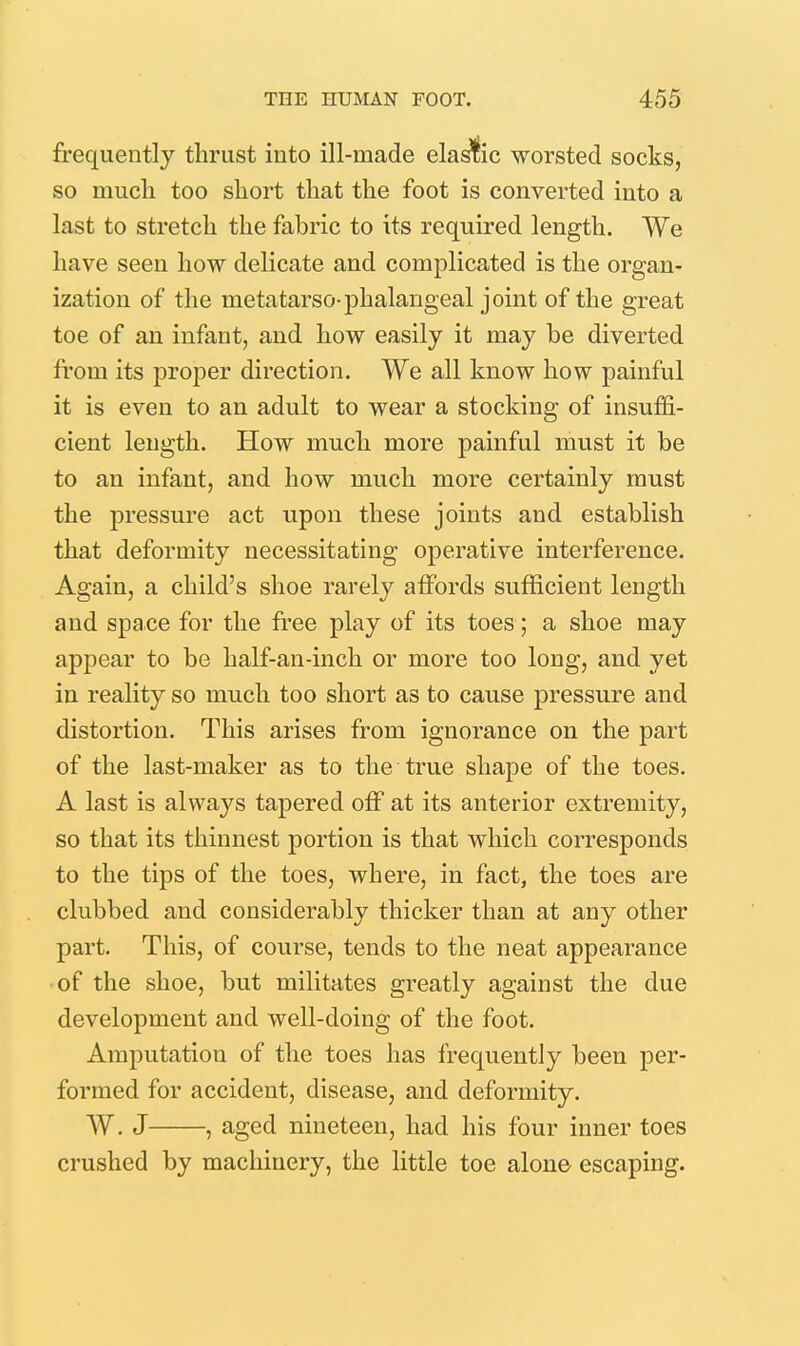 frequently thrust into ill-made ela^ic worsted socks, so much too short that the foot is converted into a last to stretch the fabric to its required length. We have seen how delicate and complicated is the organ- ization of the metatarso-phalangeal joint of the great toe of an infant, and how easily it may be diverted fi'om its proper direction. We all know how painful it is even to an adult to wear a stocking of insuffi- cient length. How much more painful must it be to an infant, and how much more certainly must the pressure act upon these joints and establish that deformity necessitating operative interference. Again, a child's shoe rarely affords sufficient length and space for the free play of its toes; a shoe may appear to be half-an-inch or more too long, and yet in reality so much too short as to cause pressure and distortion. This arises from ignorance on the part of the last-maker as to the true shape of the toes. A last is always tapered off at its anterior extremity, so that its thinnest portion is that which corresponds to the tips of the toes, where, in fact, the toes are clubbed and considerably thicker than at any other part. This, of course, tends to the neat appearance ■of the shoe, but militates greatly against the due development and well-doing of the foot. Amputation of the toes has frequently been per- formed for accident, disease, and deformity. W. J , aged nineteen, had his four inner toes crushed by machinery, the little toe alone escaping.